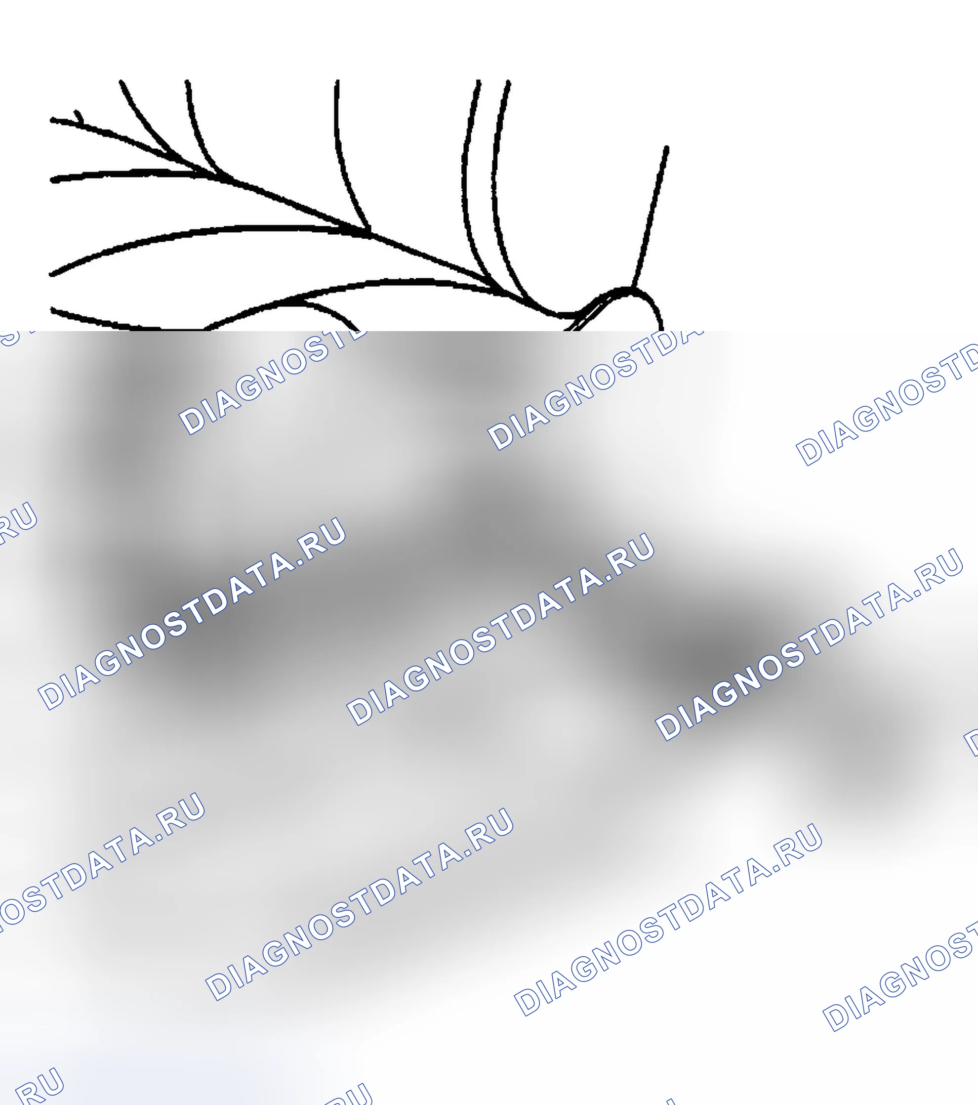 Рис. 144: Порядок демонтажа. Chevrolet Silverado 1500 HD 