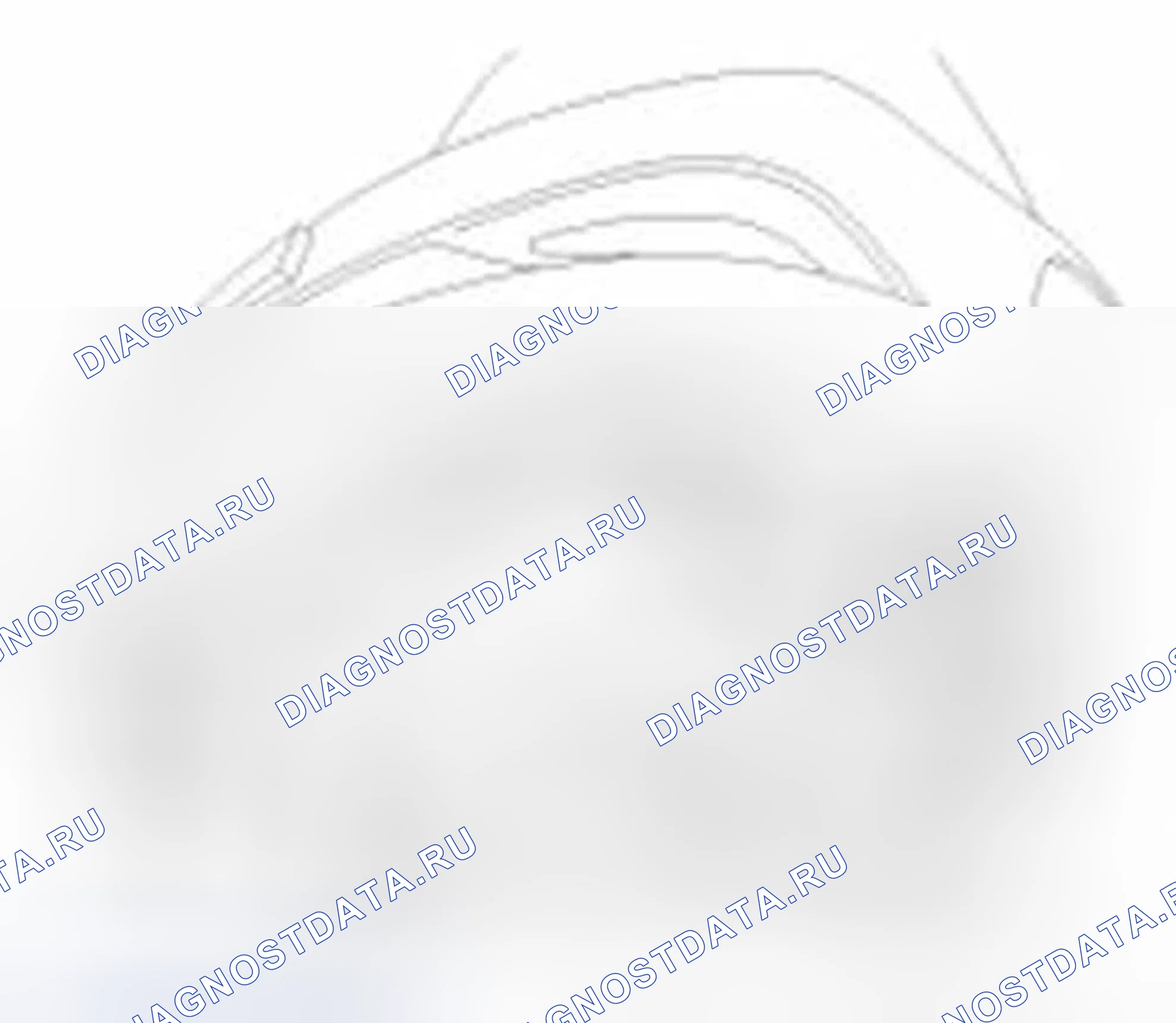 Рис. 259: Замена. Hyundai Sonata VI