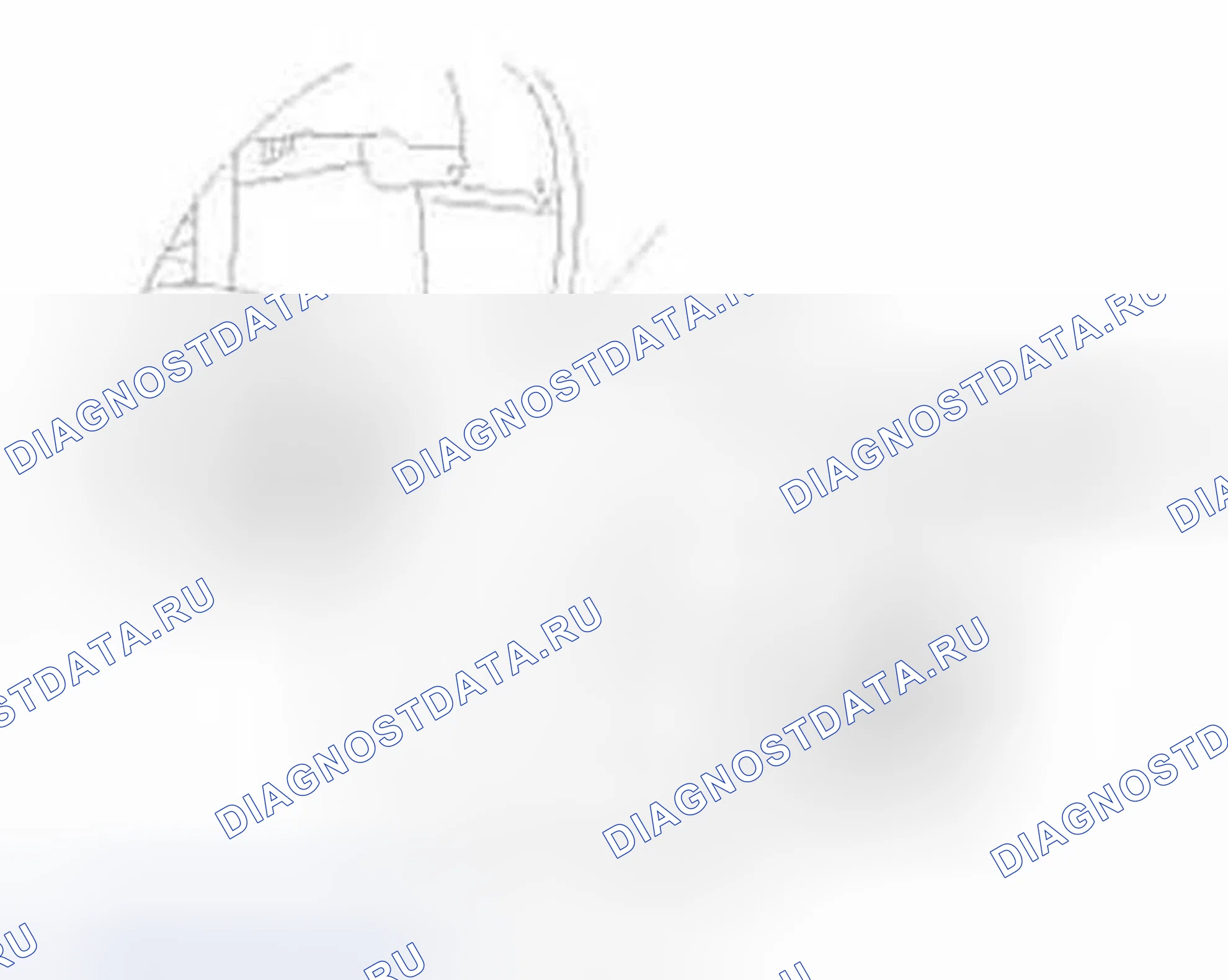 Рис. 678: Удаление. Honda Civic IX