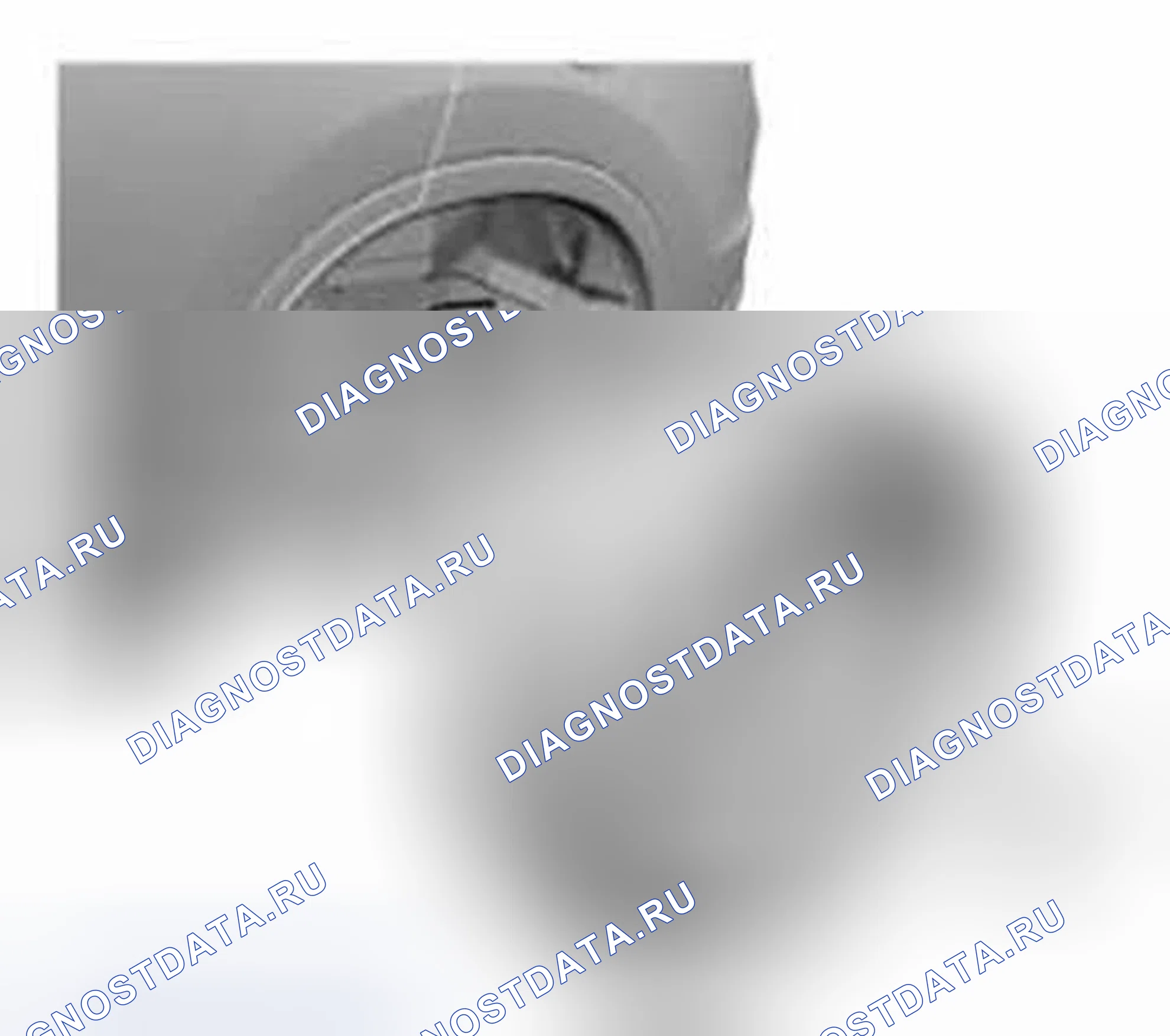 Рис. 172: Удаление. Honda CR-V IV