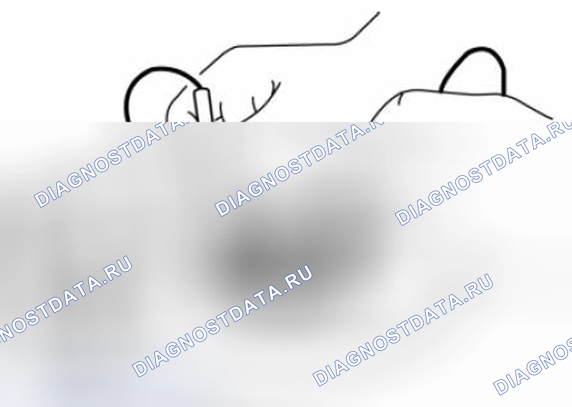 Рис. 51: Якорь. Mazda 3 BL рестайлинг