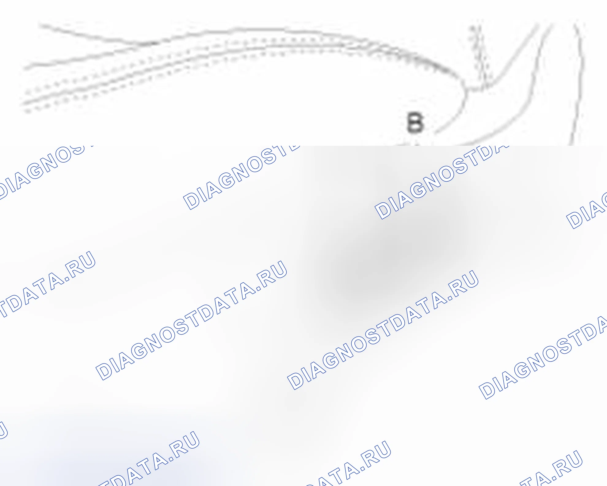 Рис. 3: Замена крышки реклайнера. Geely SC7 I