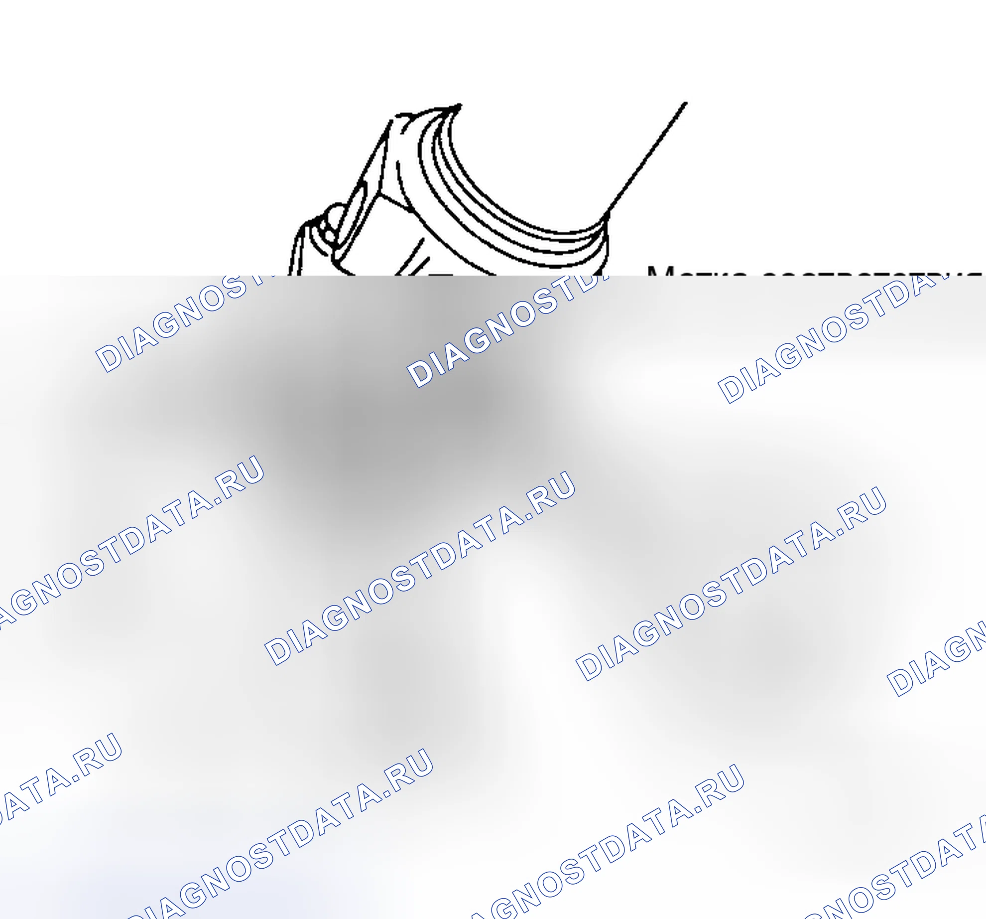 Рис. 5: ДЕМОНТАЖ. Honda Integra I