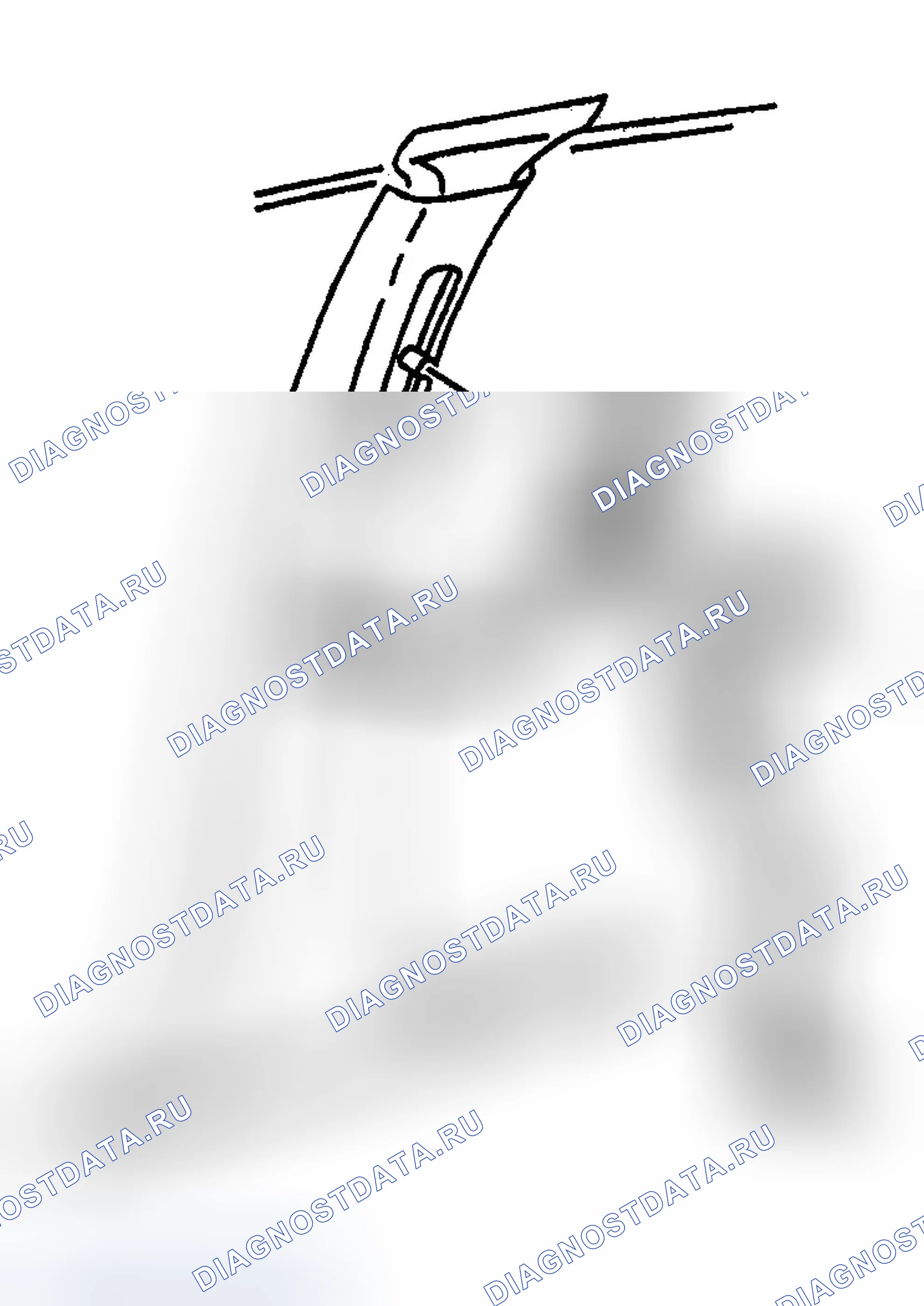 Рис. 16: Порядок демонтажа. Buick Century VI