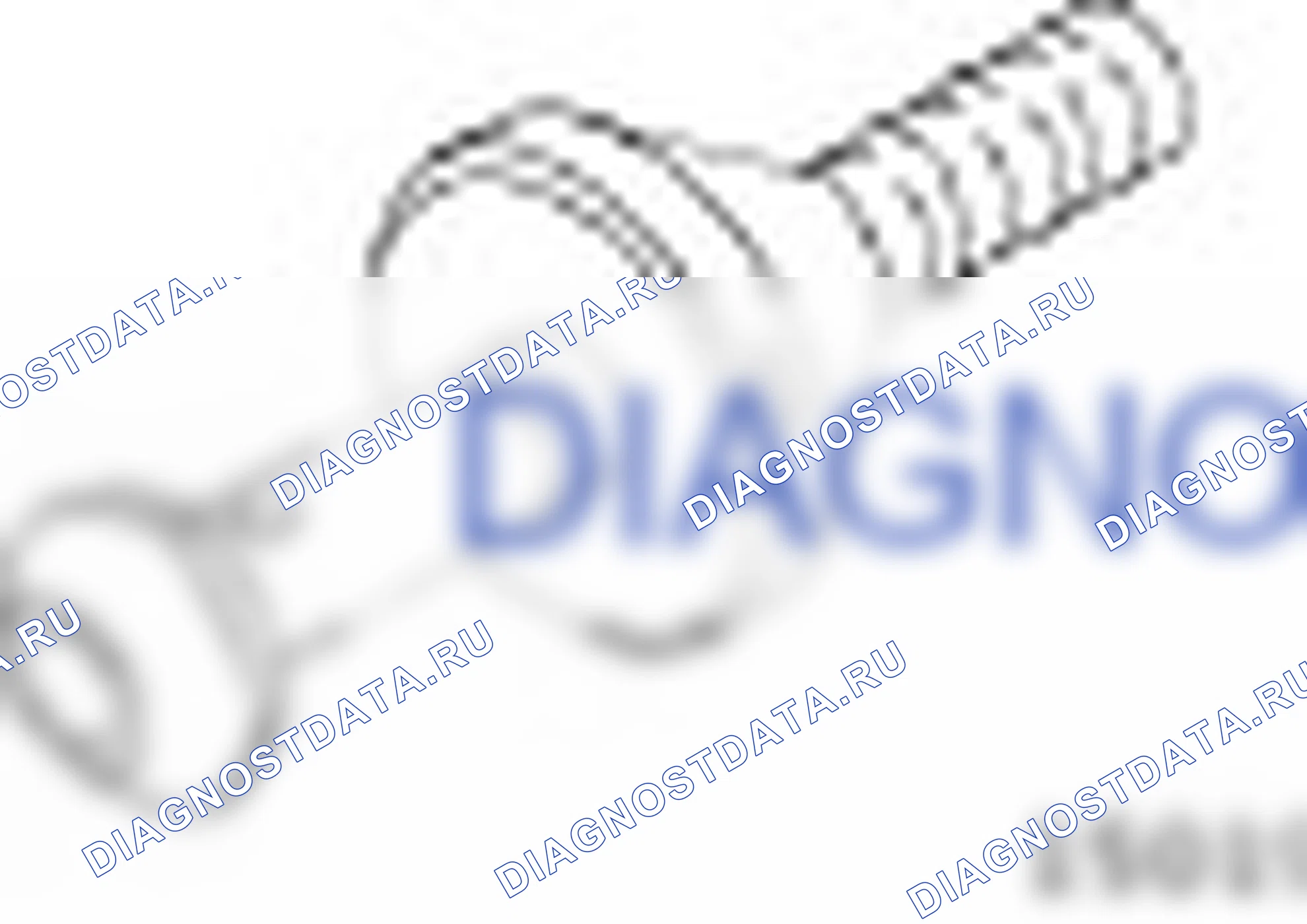 205-058 (15-019) — Мерное приспособление для ведущей шестерни. Ford Transit VI