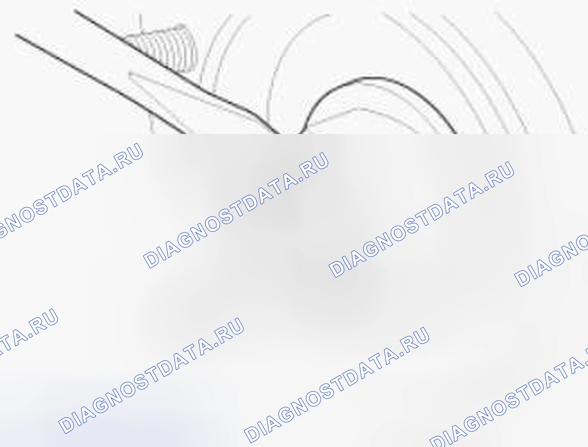 Рис. 8. Hyundai Accent IV