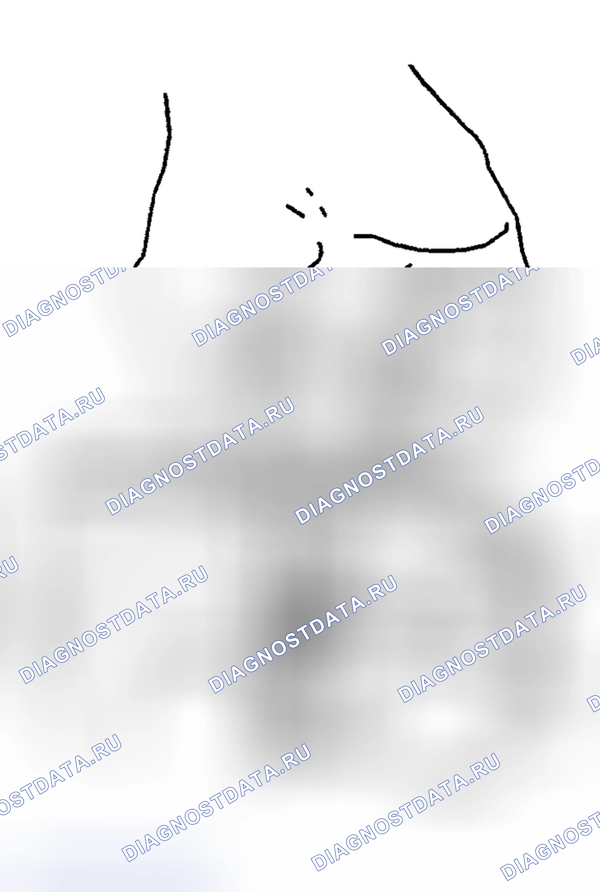 Рис. 8. Hyundai Venue I