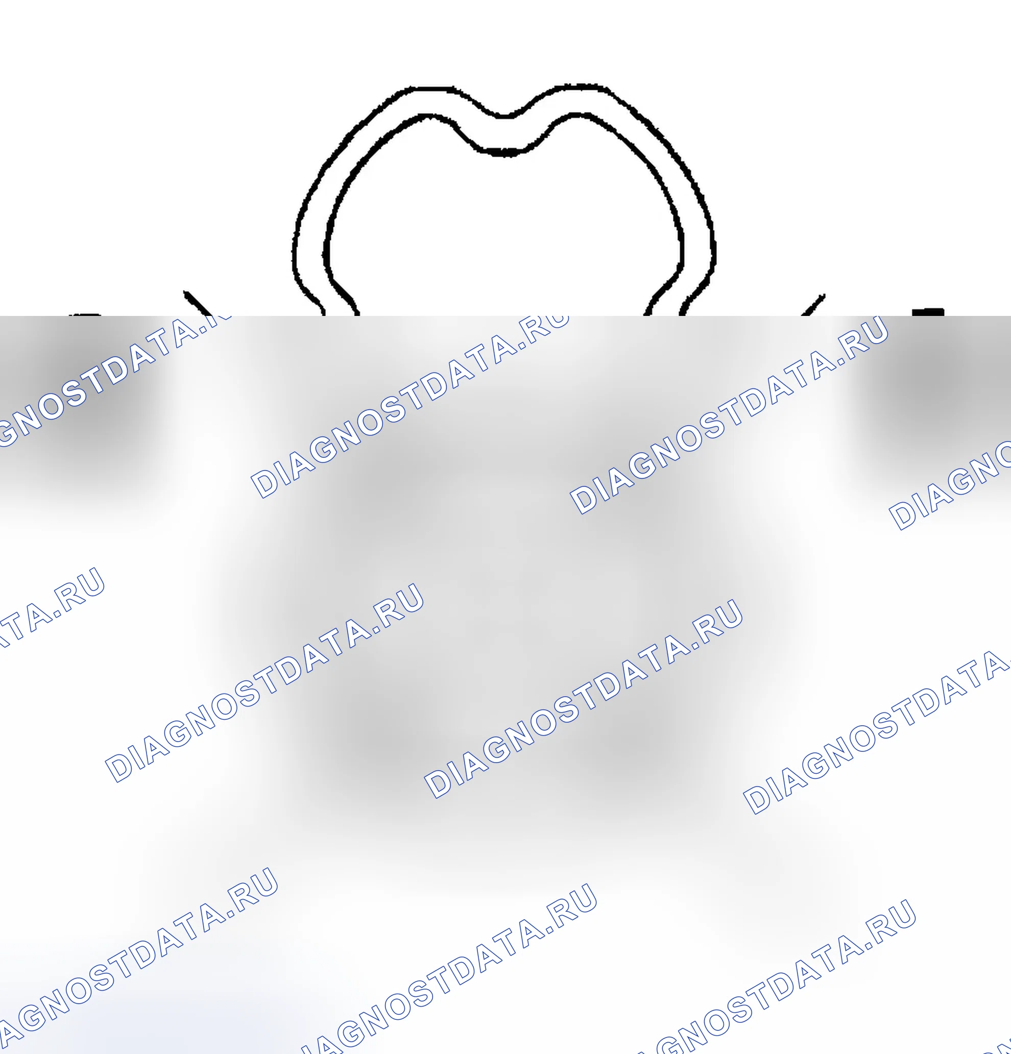 Рис. 105. Buick Century VI