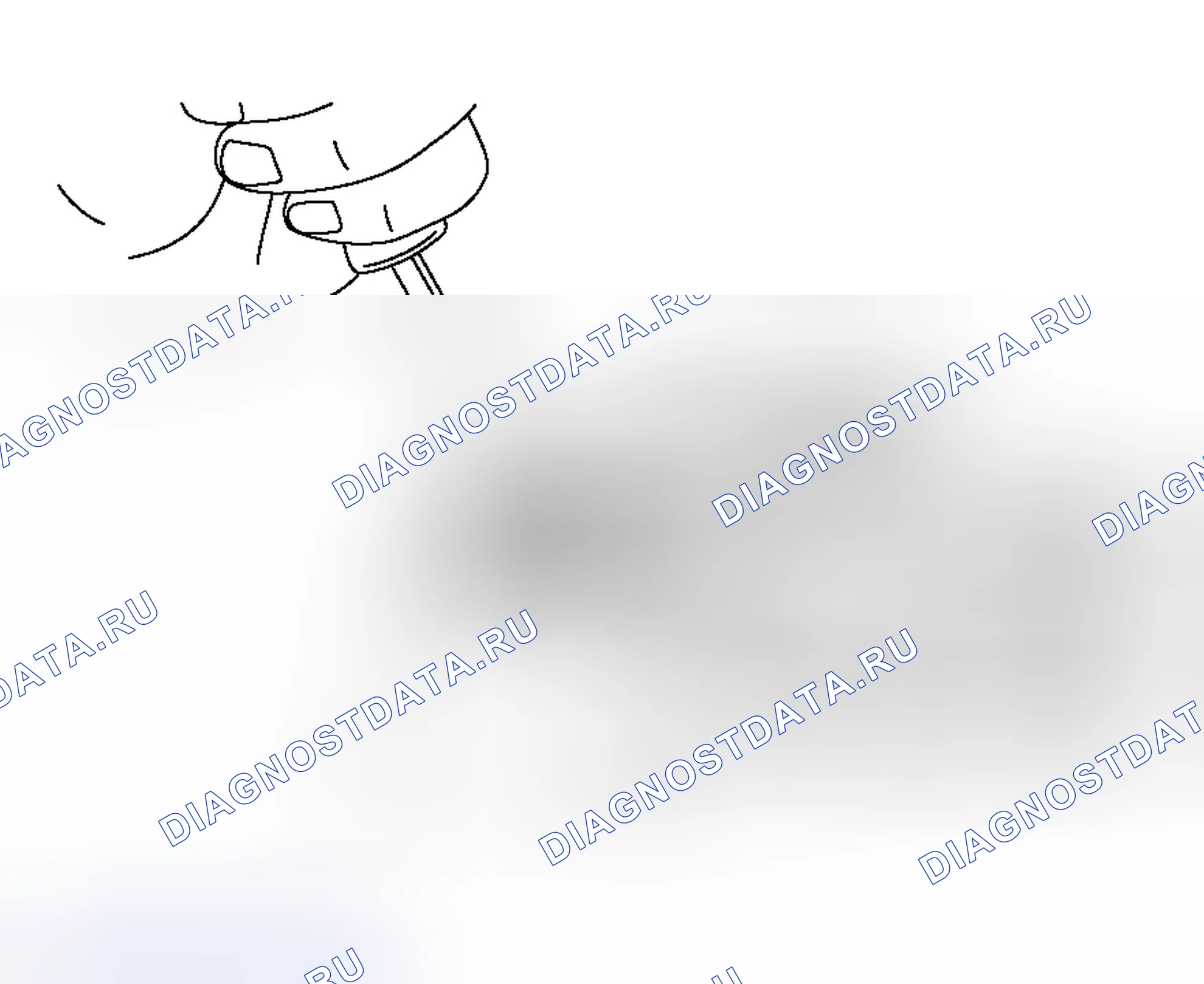 Рис. 112: < < A > > СНЯТИЕ УПЛОТНИТЕЛЬНОЙ КРЫШКИ. Mitsubishi Outlander I