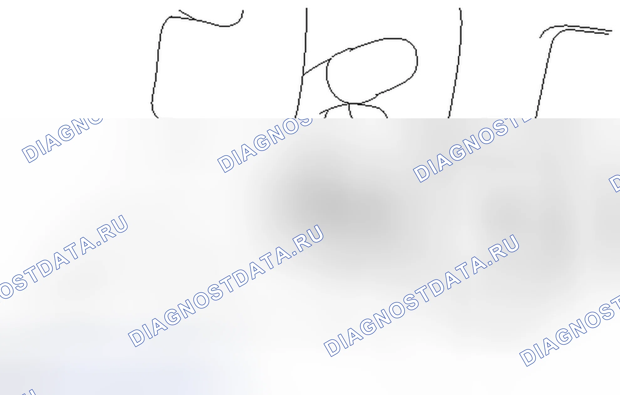 Рис. 45: УДАЛЕНИЕ [12 / 2013 -]. Kia Sorento IV
