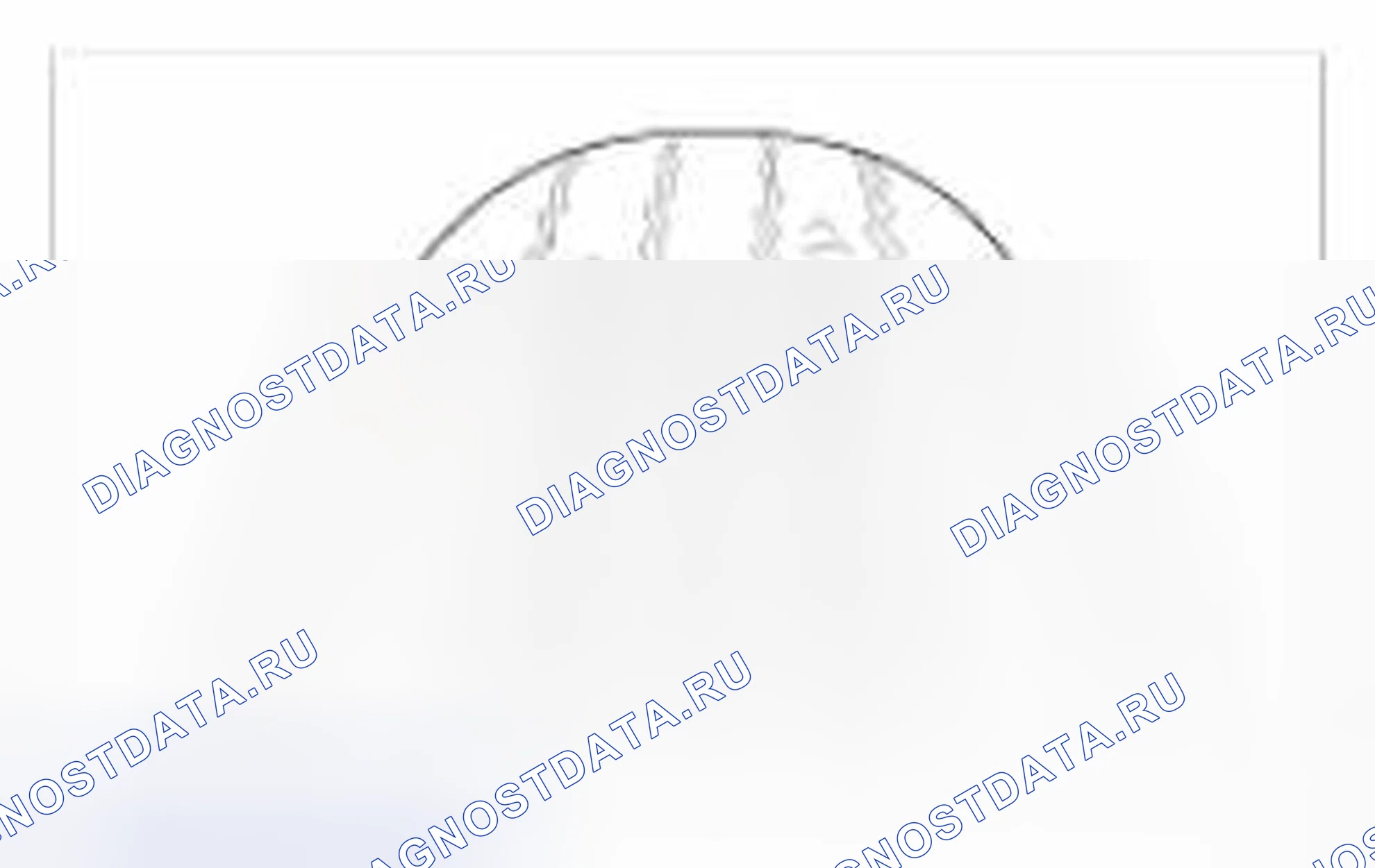 Рис. 43. Hyundai Accent IV