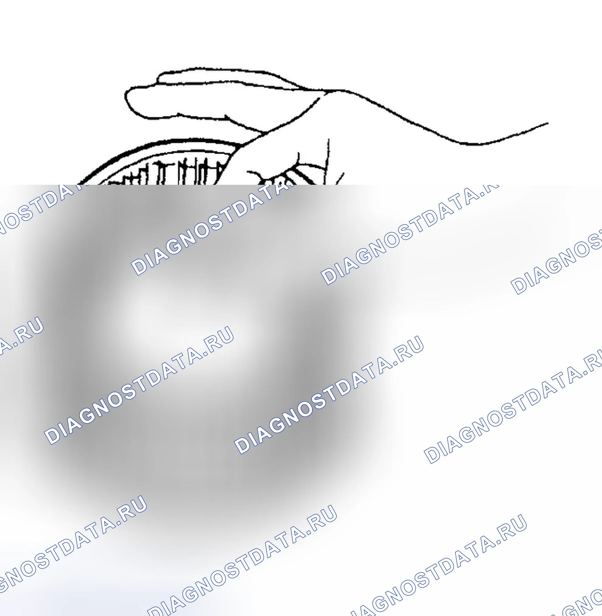 Рис. 126. Hyundai Elantra III