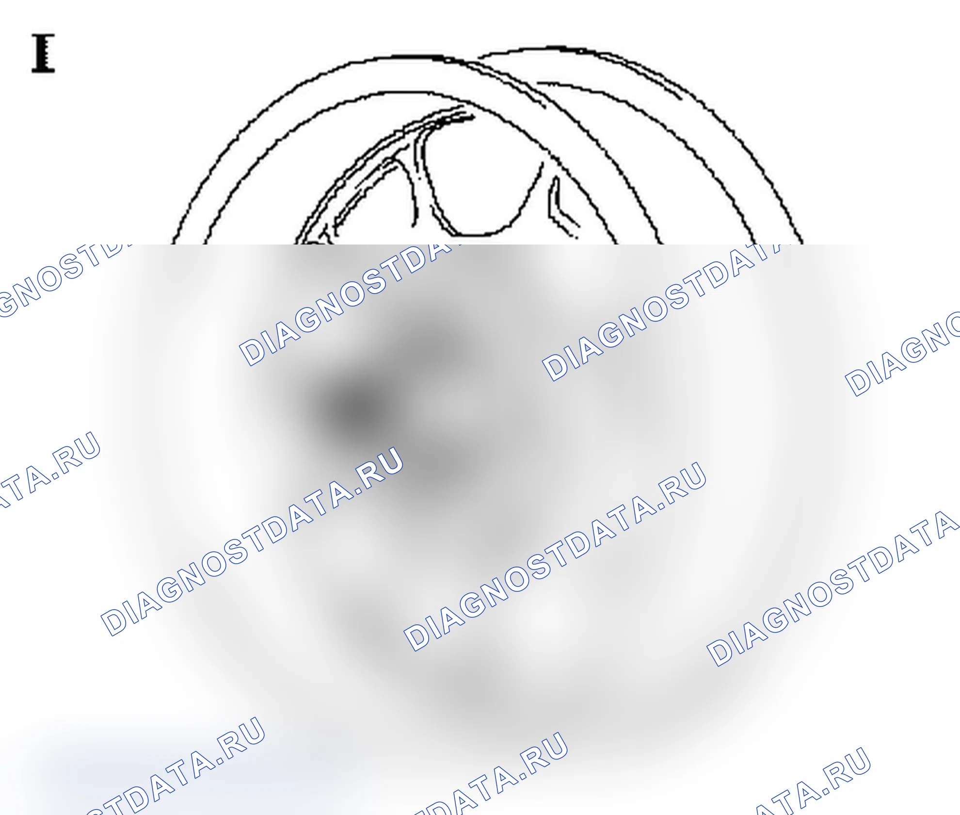 Alloy rim 'Riviera Edition' - Vibration during driving. Opel Agila A рестайлинг
