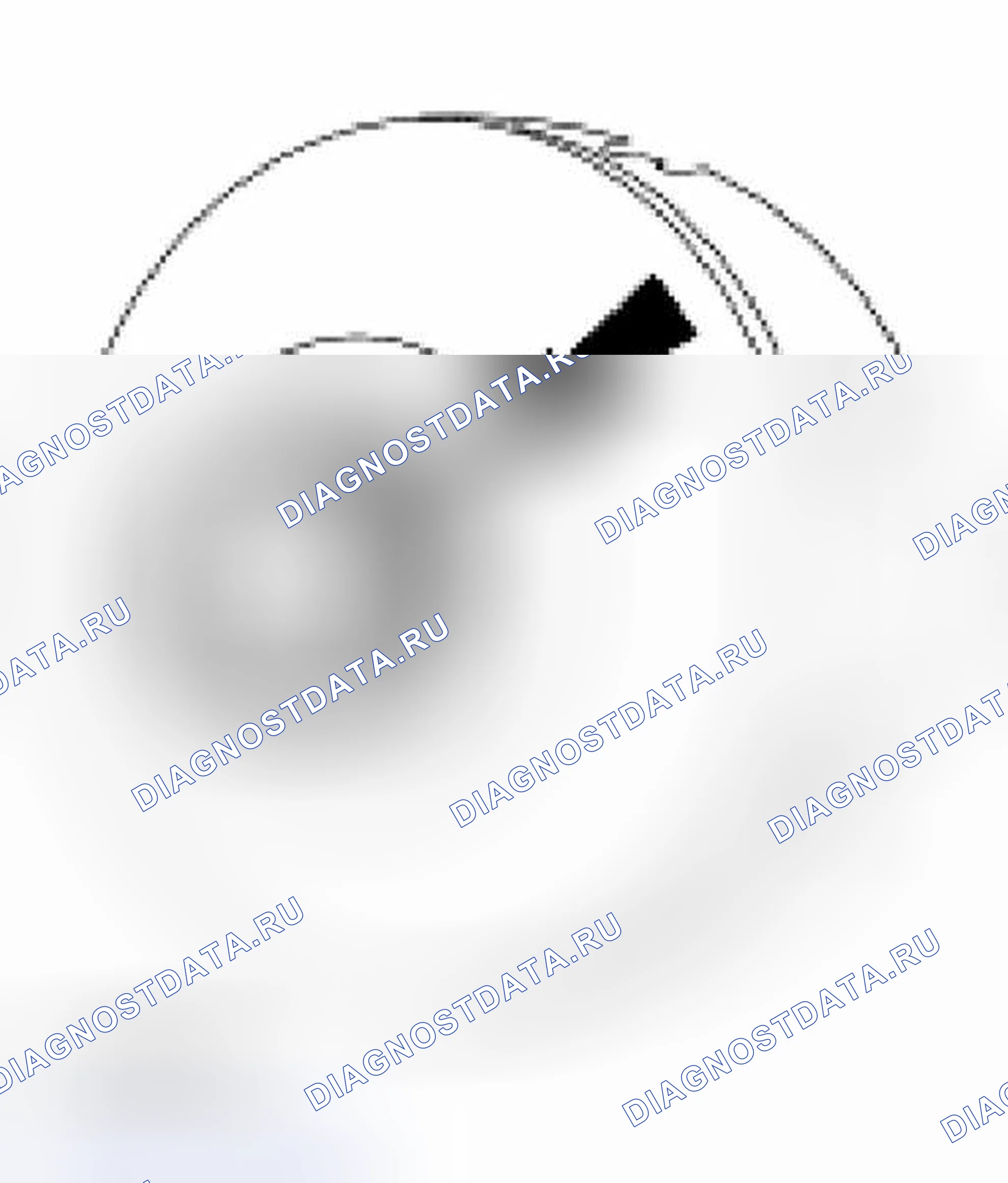 Рис. 299: Разборка. Hyundai Lavita I