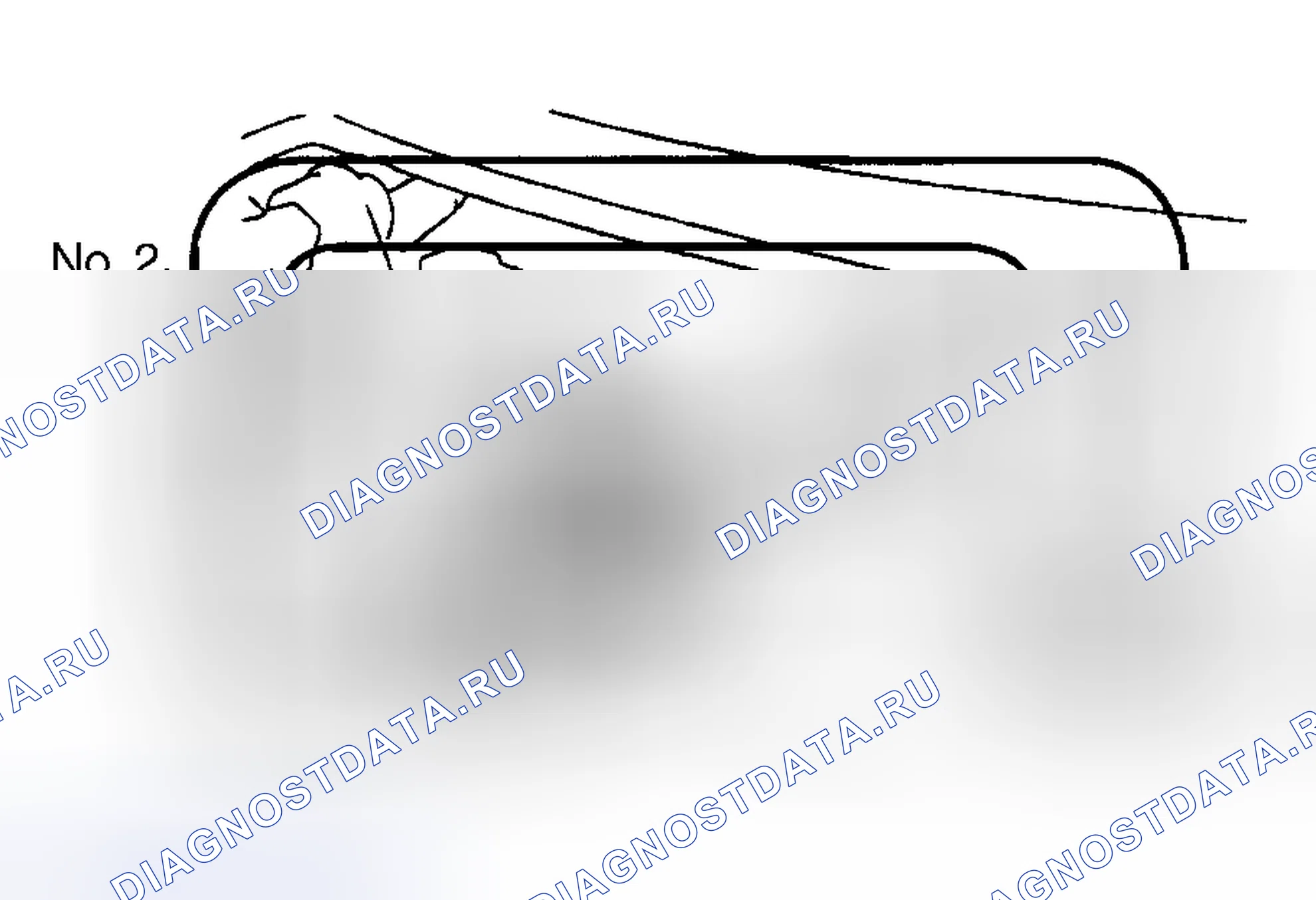 Рис. 8: Соленоид управления блокировкой дифференциала. Toyota RAV4 I