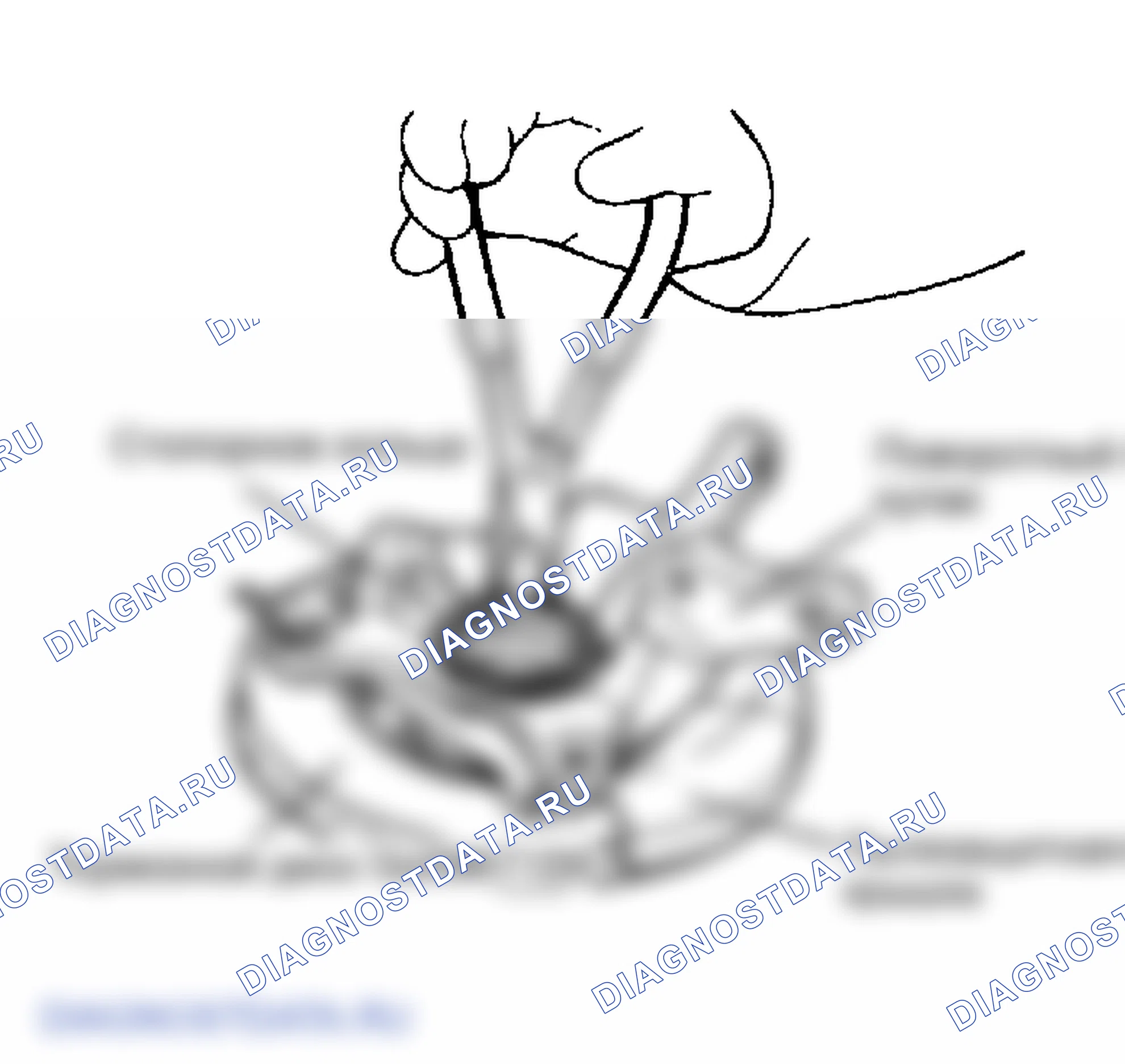 Рис. 17: РАЗБОРКА. Hyundai Accent II рестайлинг