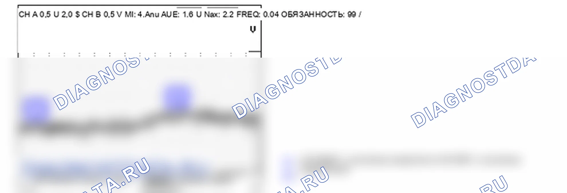 P0532: кондиционера датчик давления хладагента А контур низкий уровень сигнала. Hyundai Santa Fe CM
