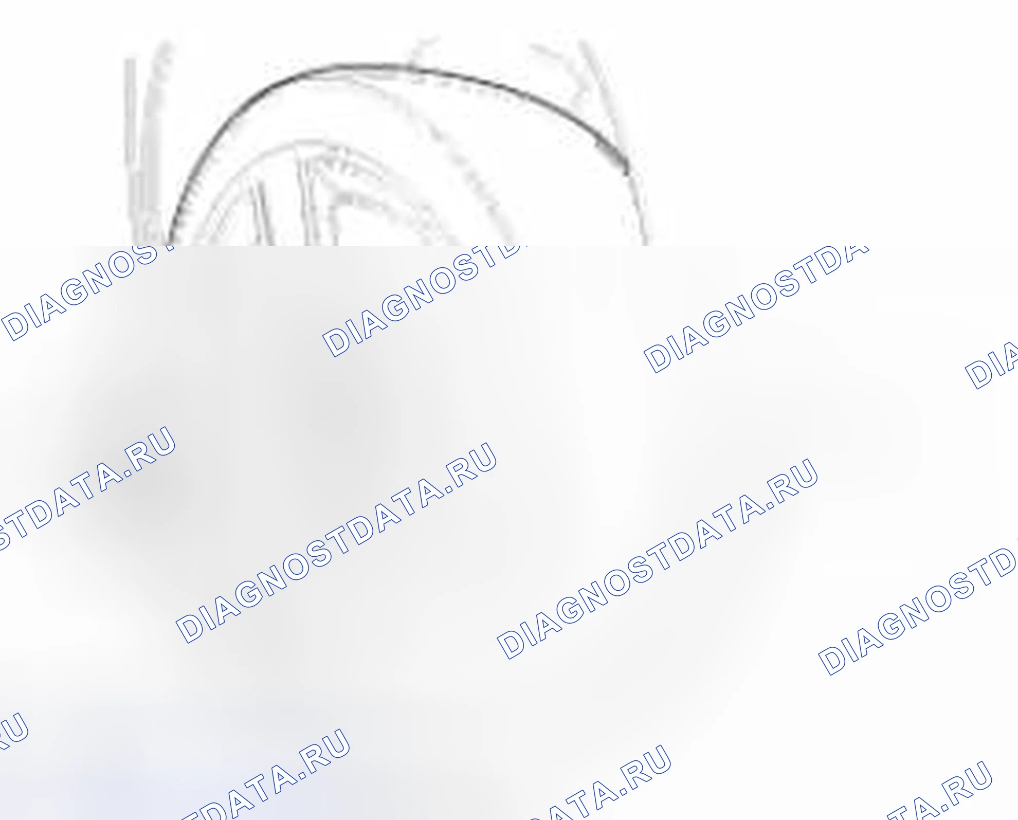 Рис. 2: Замена. Geely Vision X3 Pro I