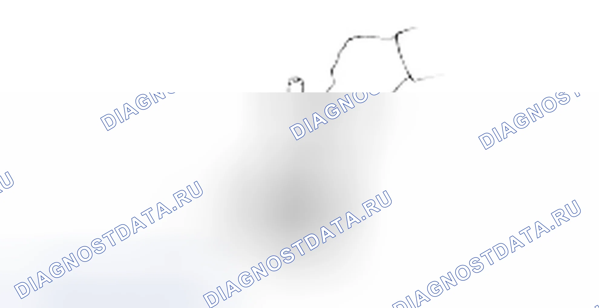 Разборка муфты реверса и овердрайва. Hyundai H-1 A1