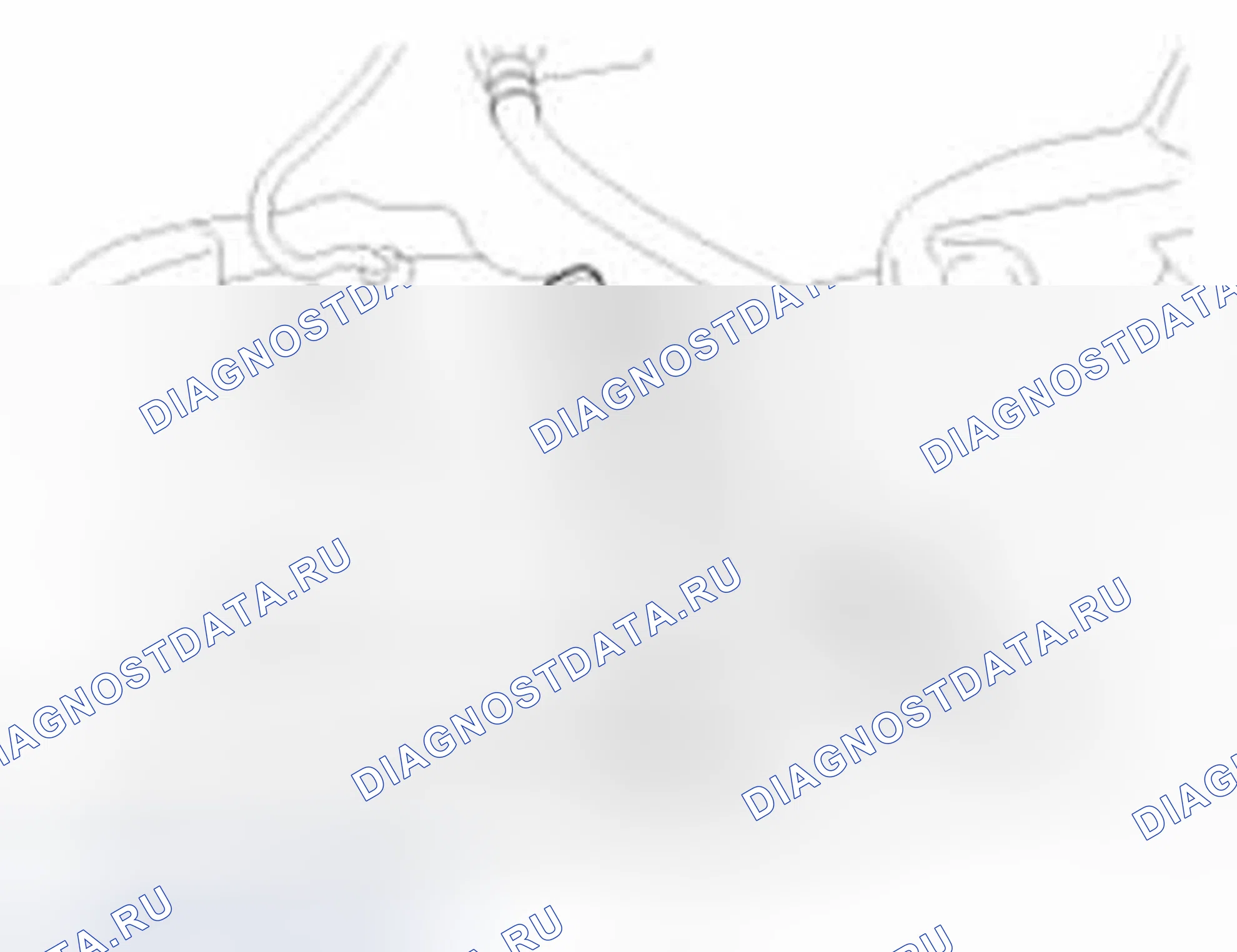 Рис. 40. Hyundai Elantra V
