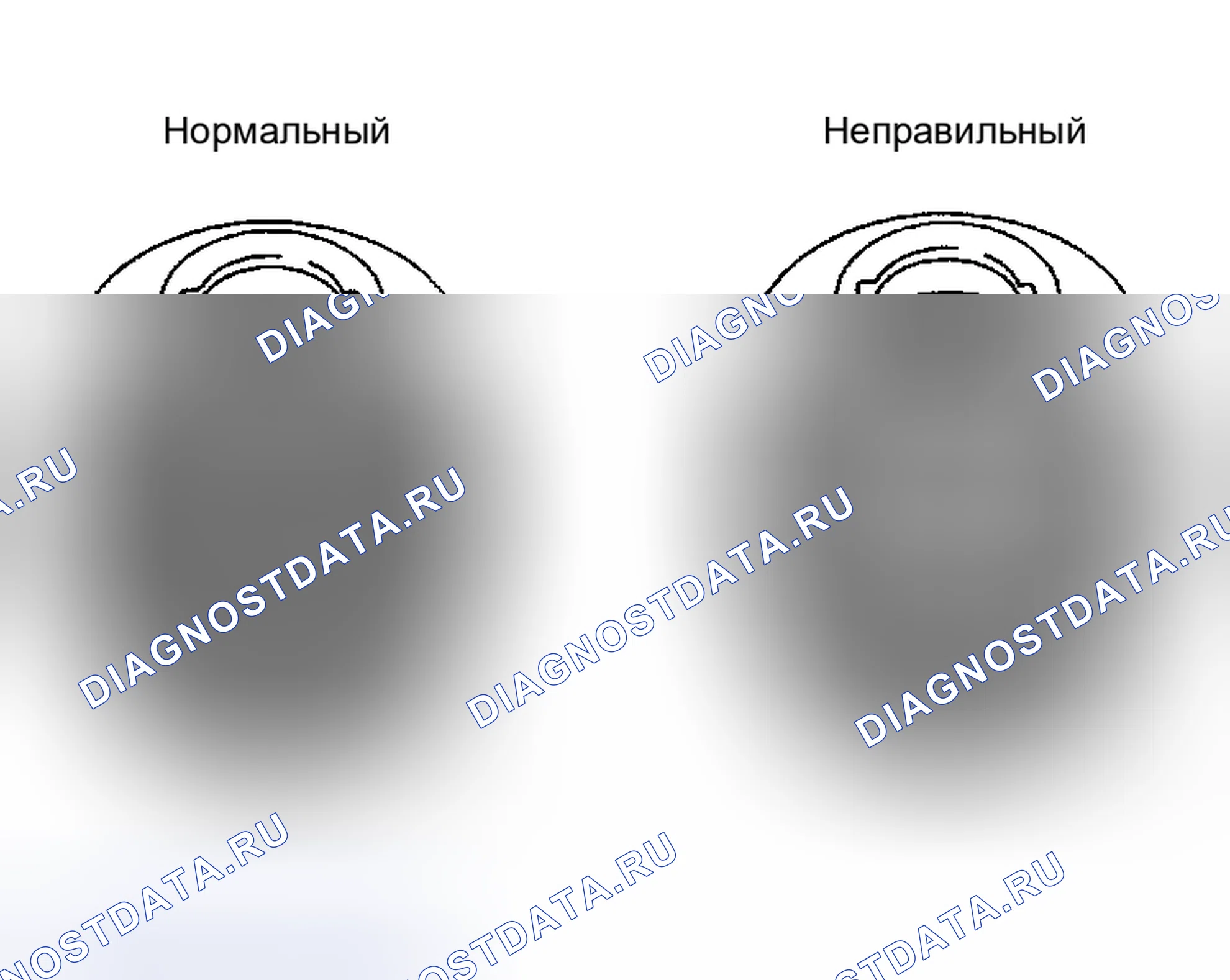Рис. 3: КРОВОТЕЧЕНИЕ. Haval Xiaolong Max I