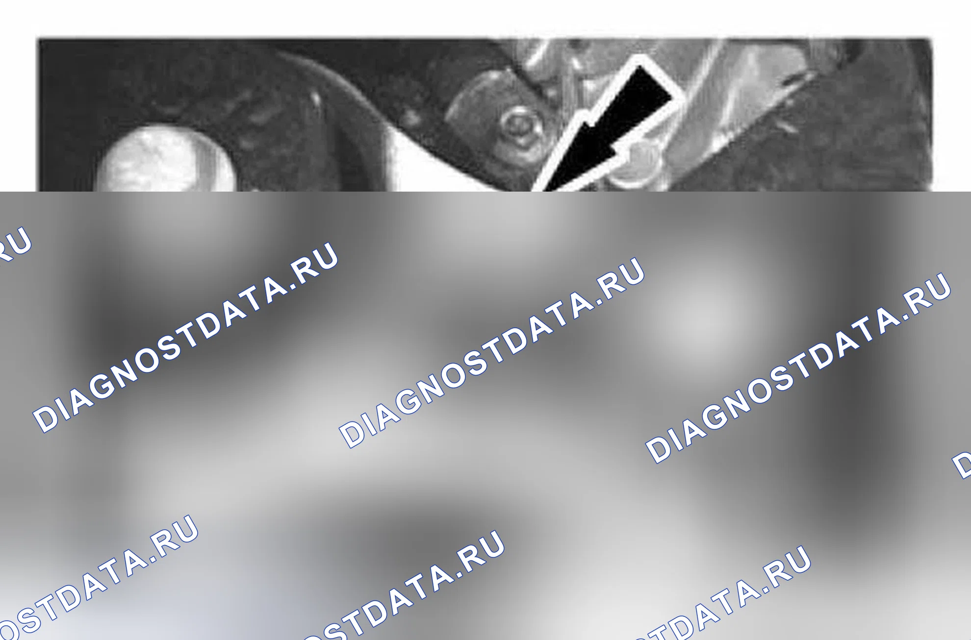 Рис. 81: Удаление. Ford Fiesta Mk6