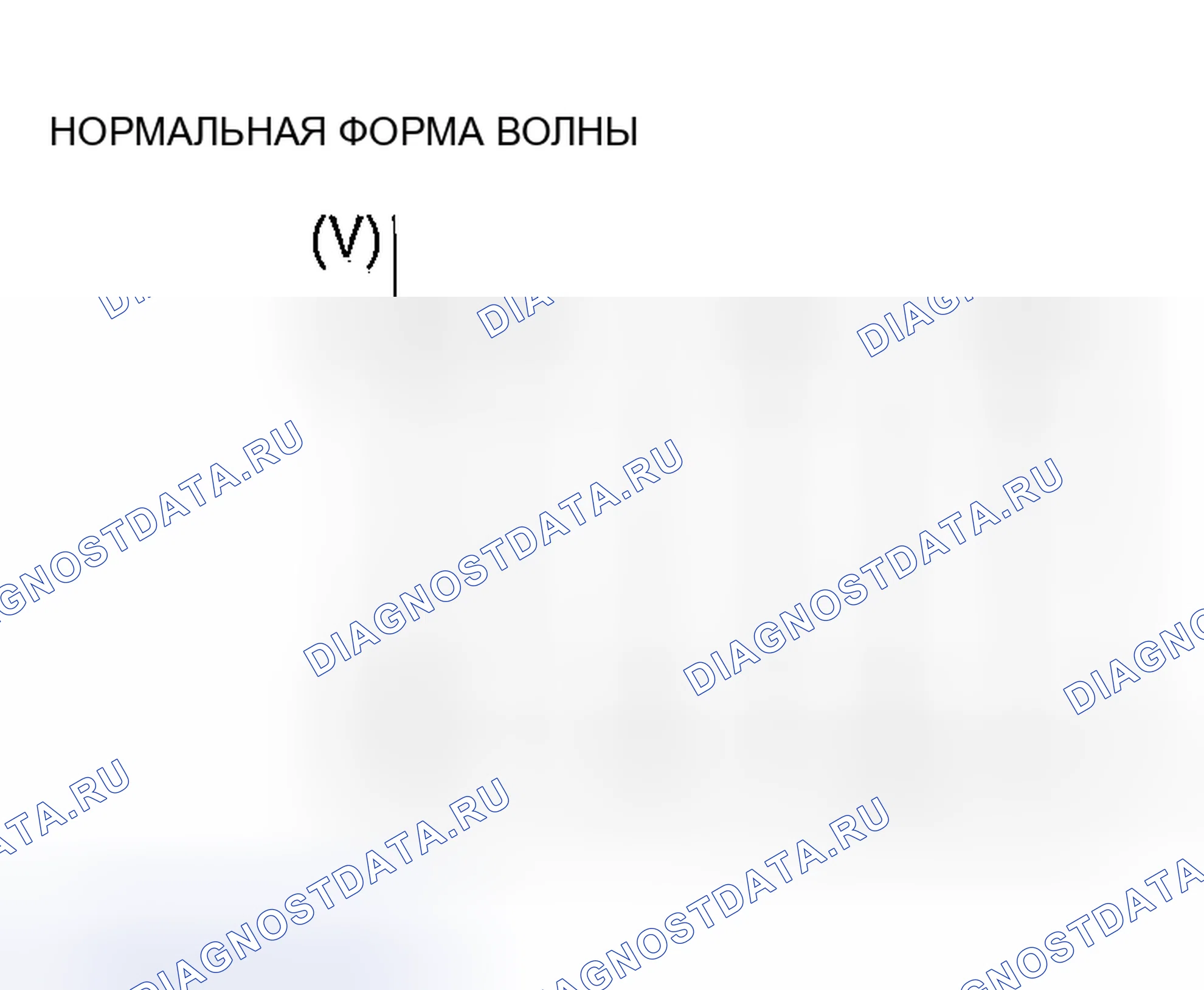 Рис. 1572. Mazda MX-5 NA