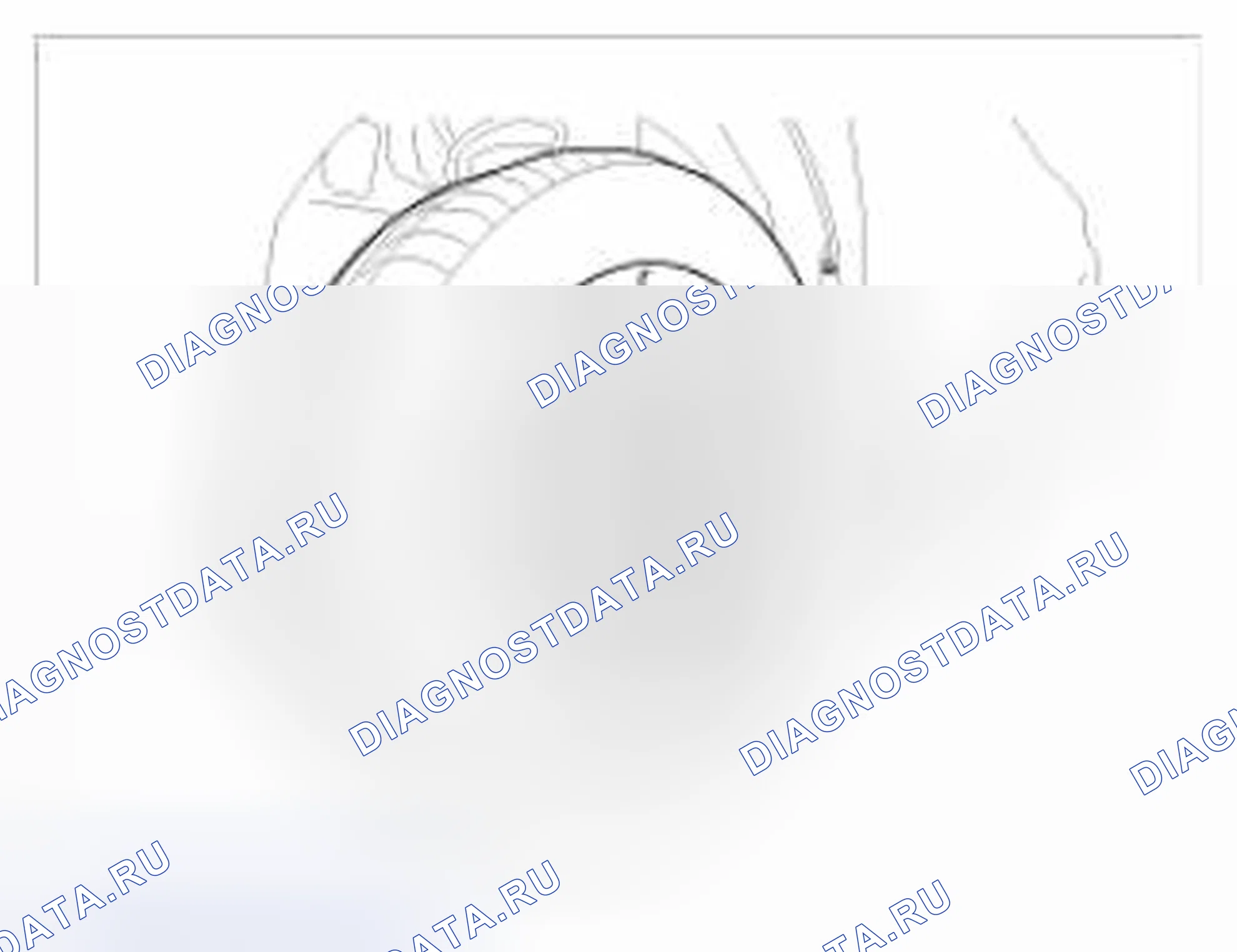 Рис. 15: Замена. BMW 6 серия F06/F13/F12