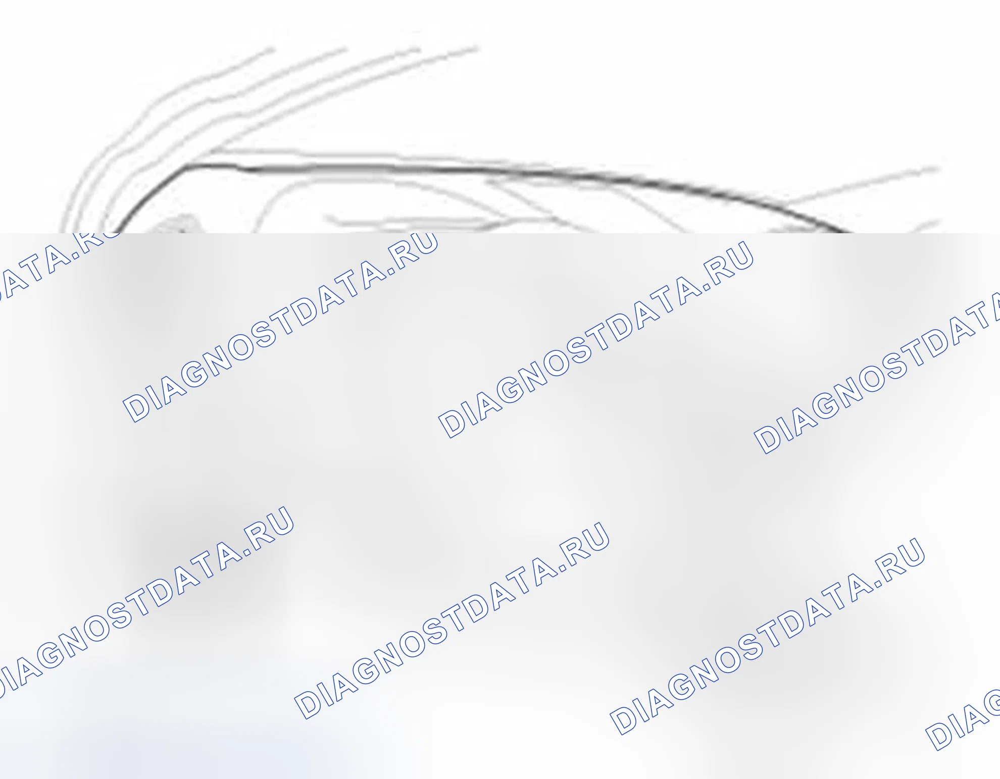 Рис. 441: Регистрация кода передатчика (с использованием GDS). Hyundai Sonata VI