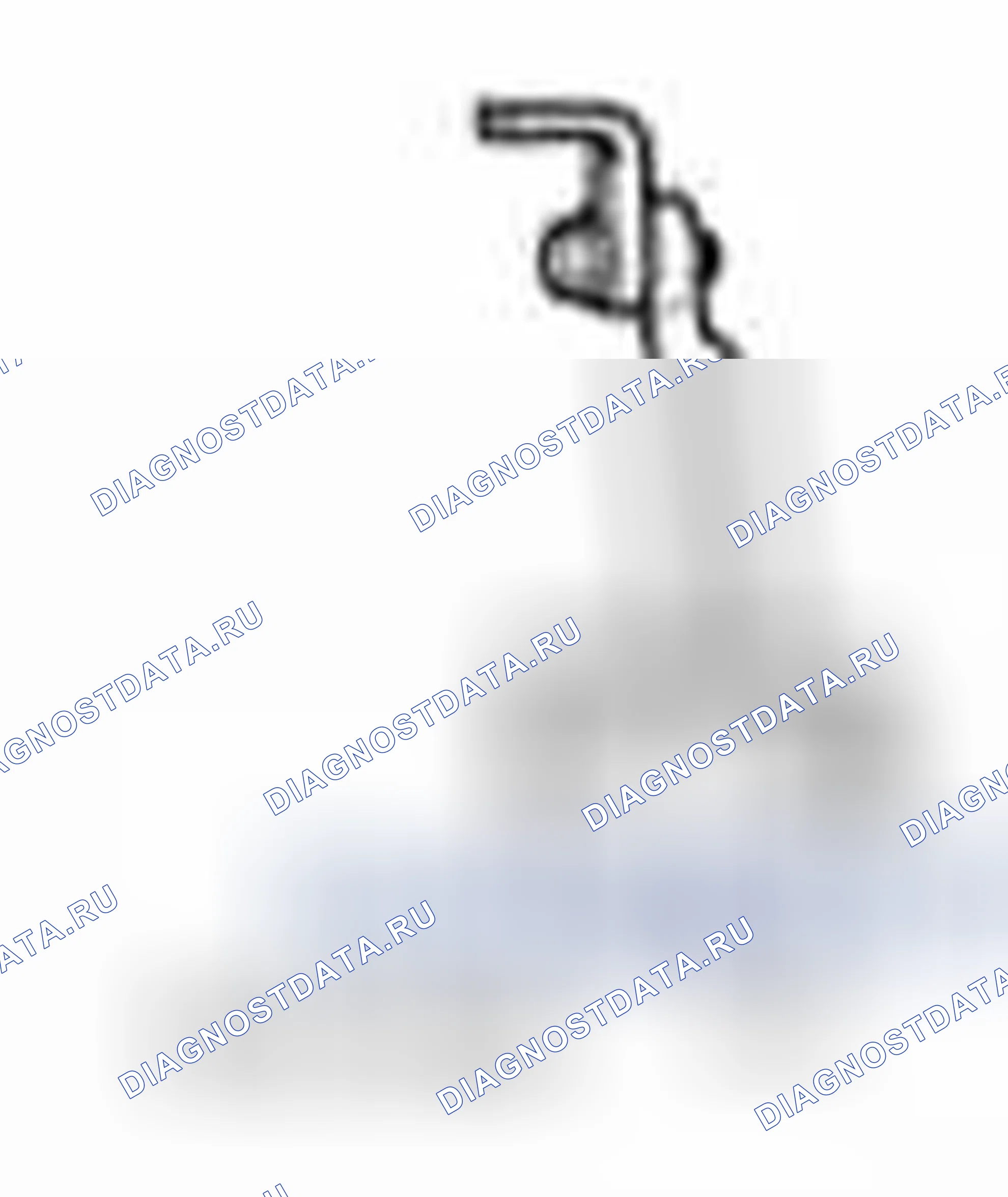 Рис. 155. Ford Fiesta Mk6