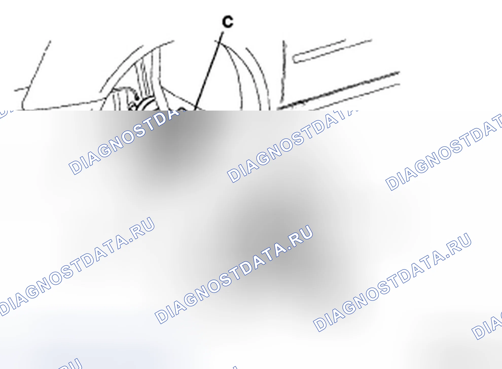 Рис. 3: ДЕМОНТАЖ. Hyundai Azera I