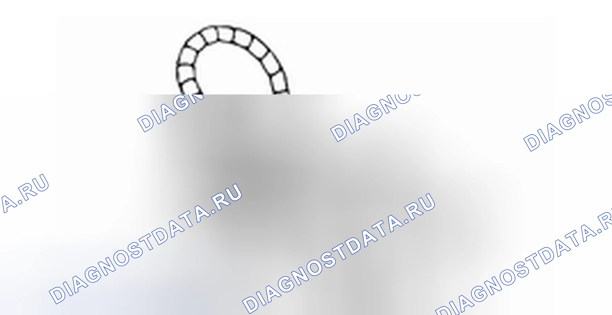 Проверка заднего держателя дифференциала. Hyundai H-1 A1