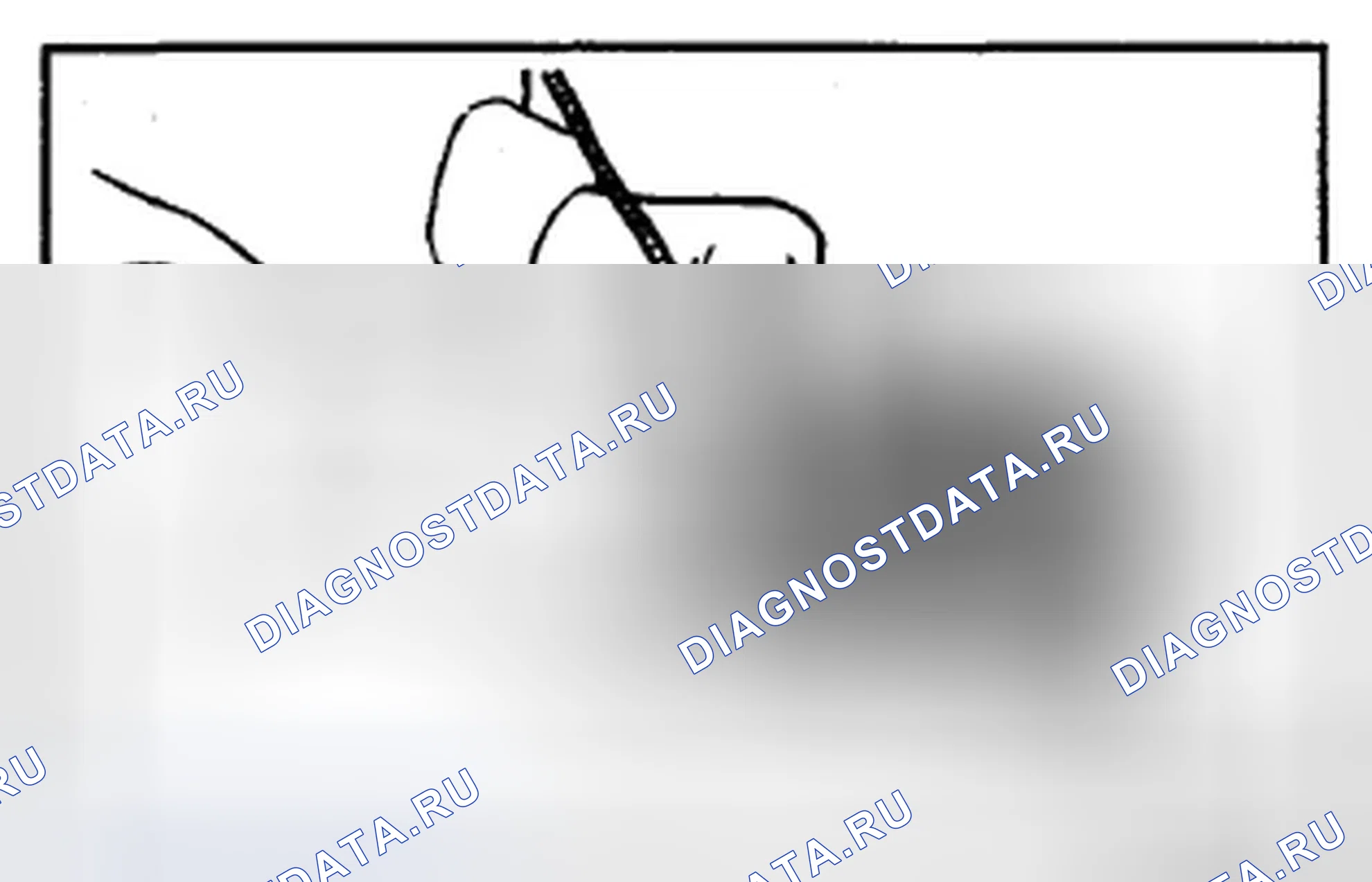 Рис. 196. Hyundai Accent I