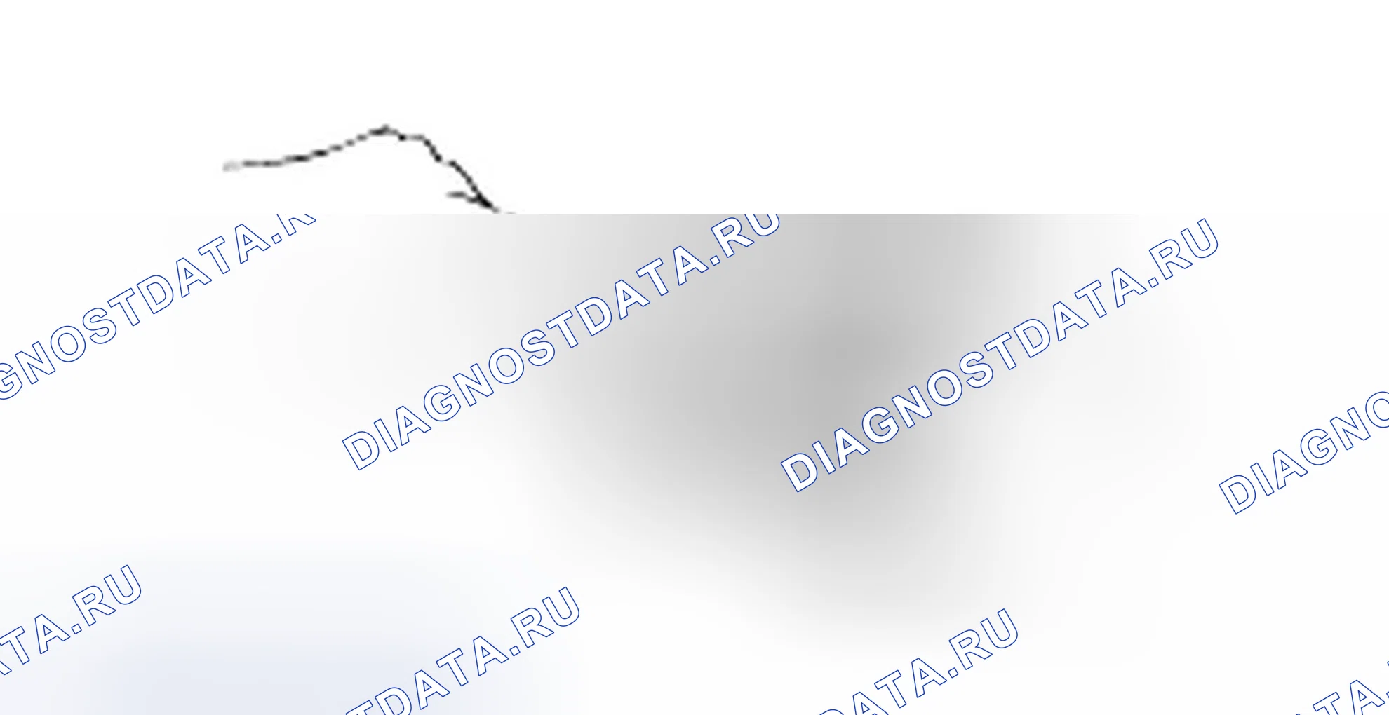 Разборка выходного вала. Hyundai H-1 A1