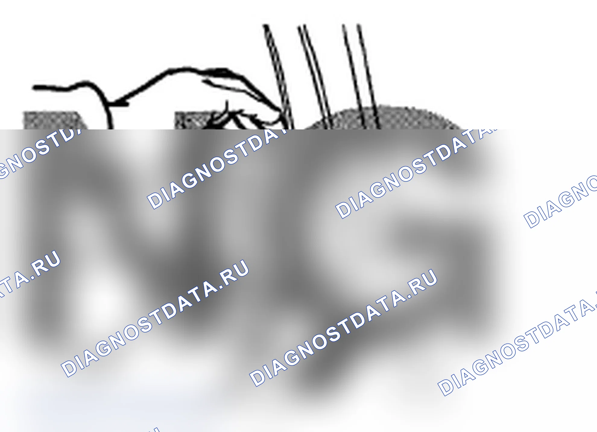 Рис. 265. Subaru Impreza WRX STI GR