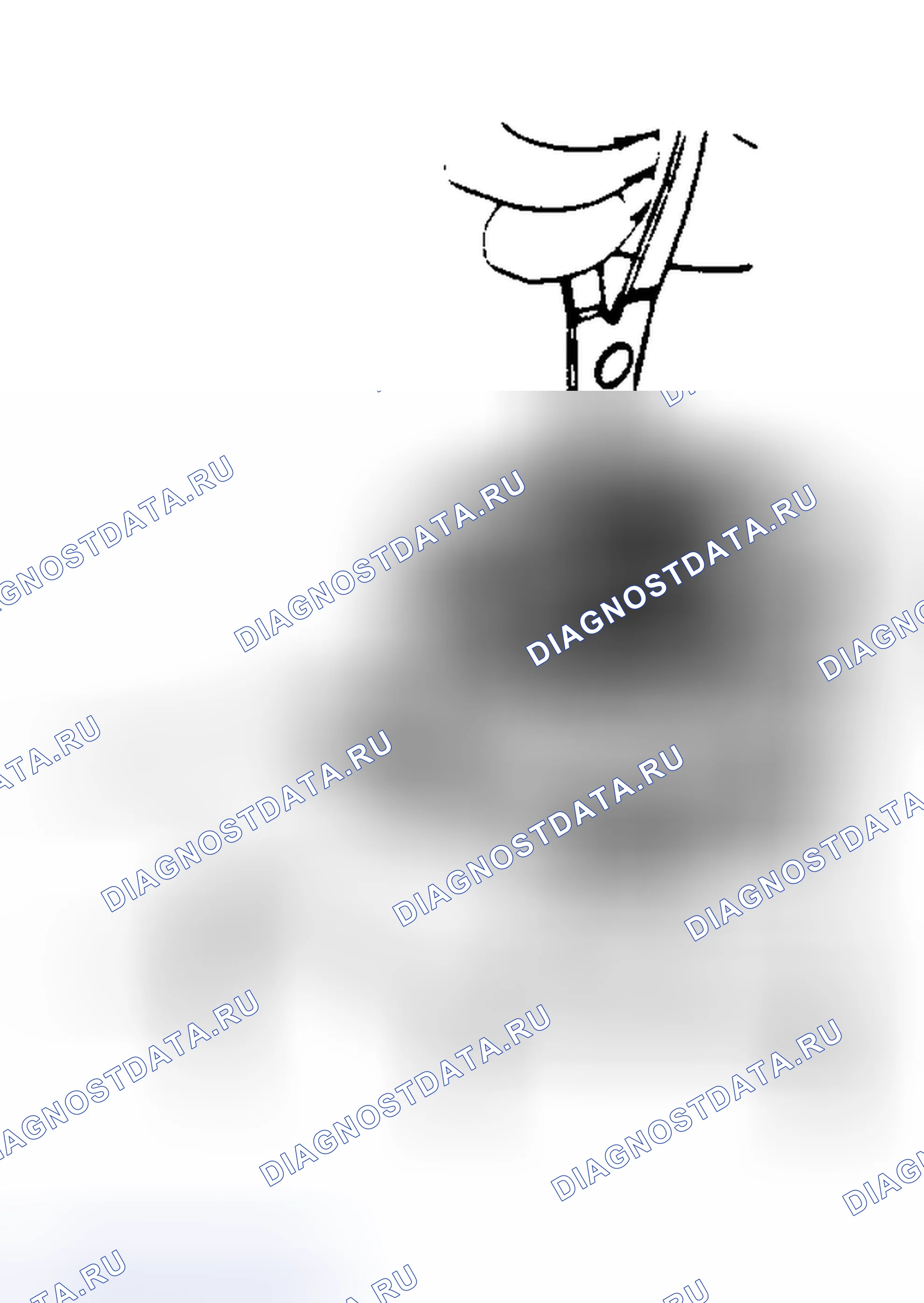 Рис. 94: Демонтаж зажимного кольца - Инструмент № 6-External Зажимные кольцевые щипцы. Buick Electra V