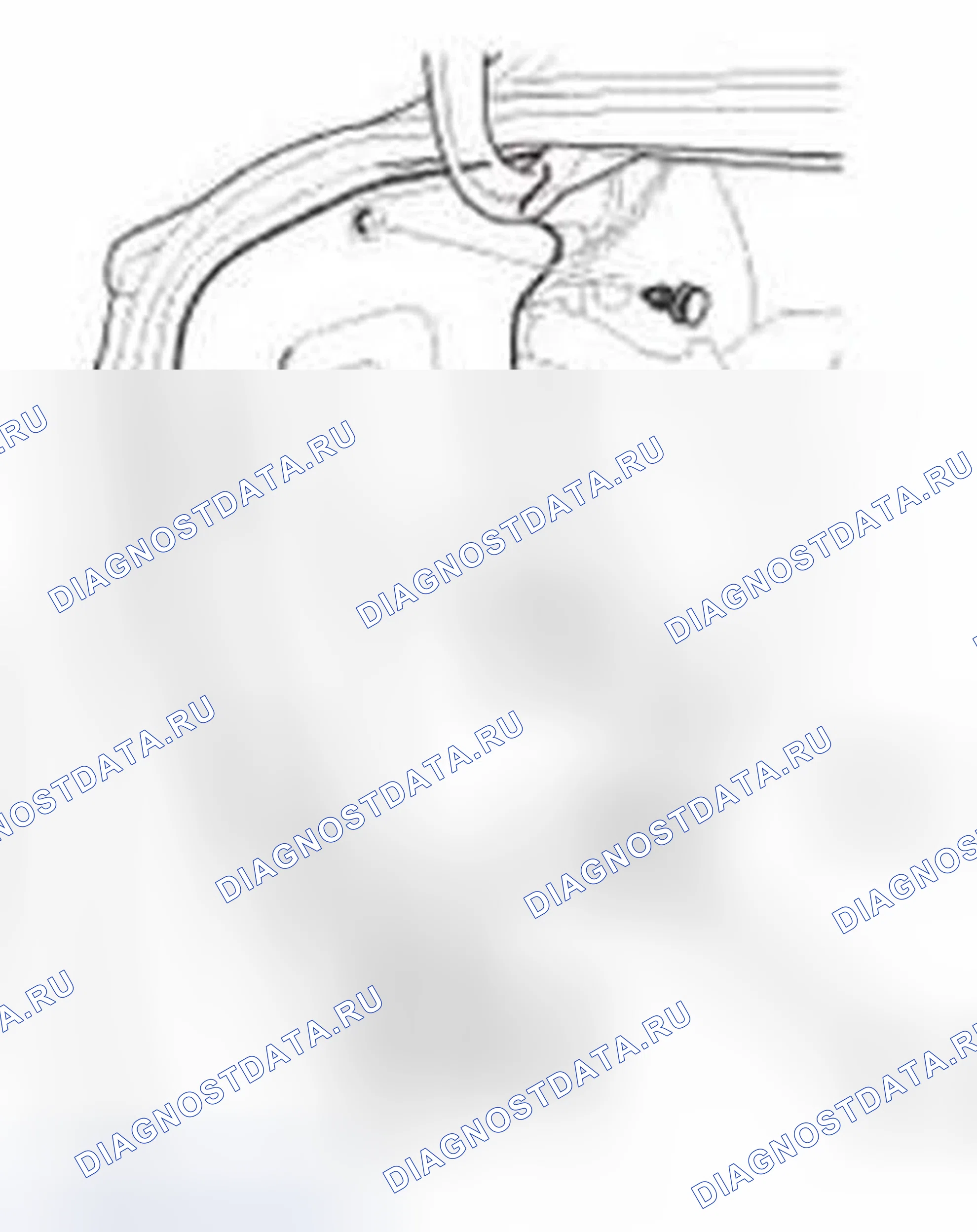 Рис. 157. Honda Civic IX