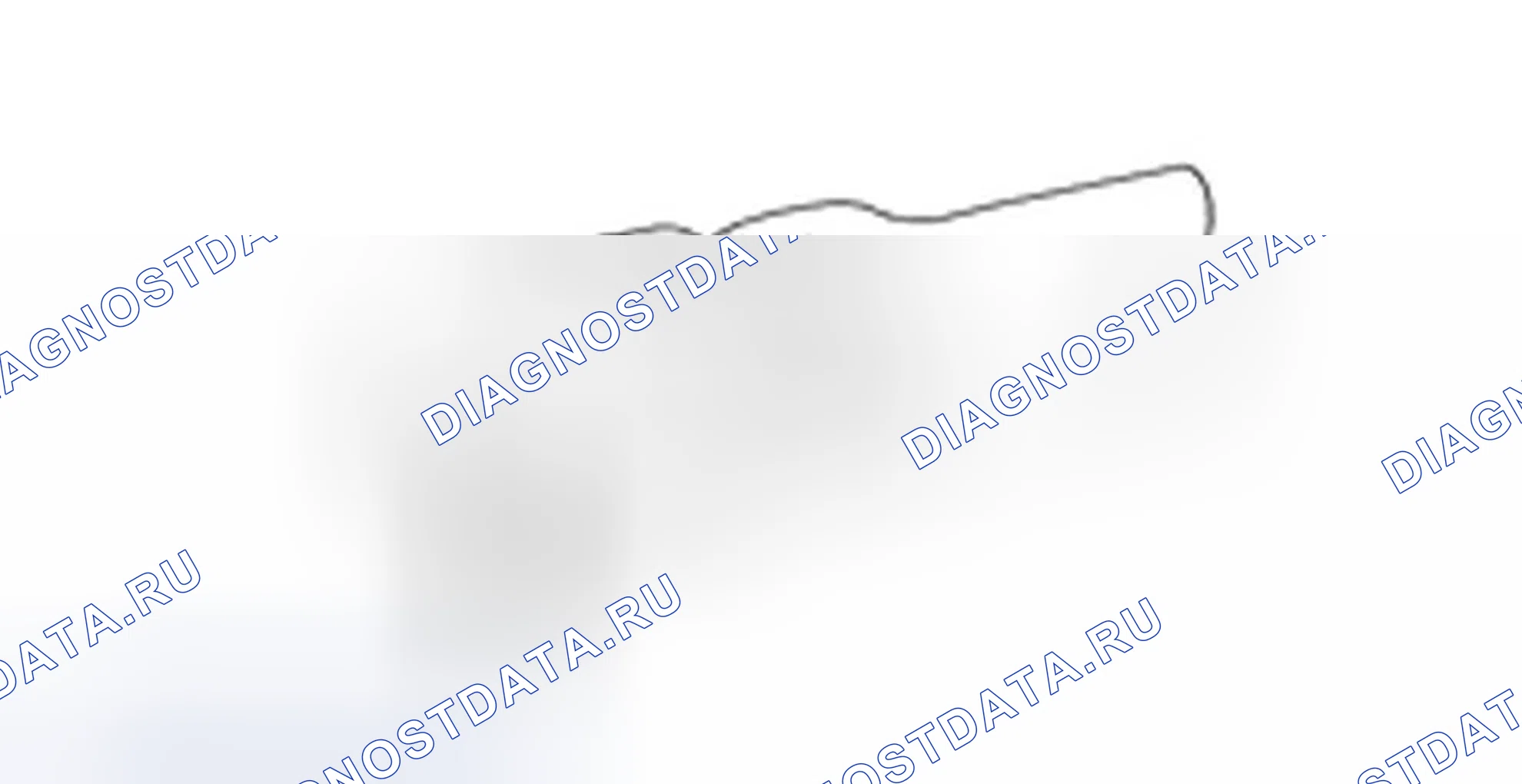 Установка карданного вала. Hyundai H-1 A1