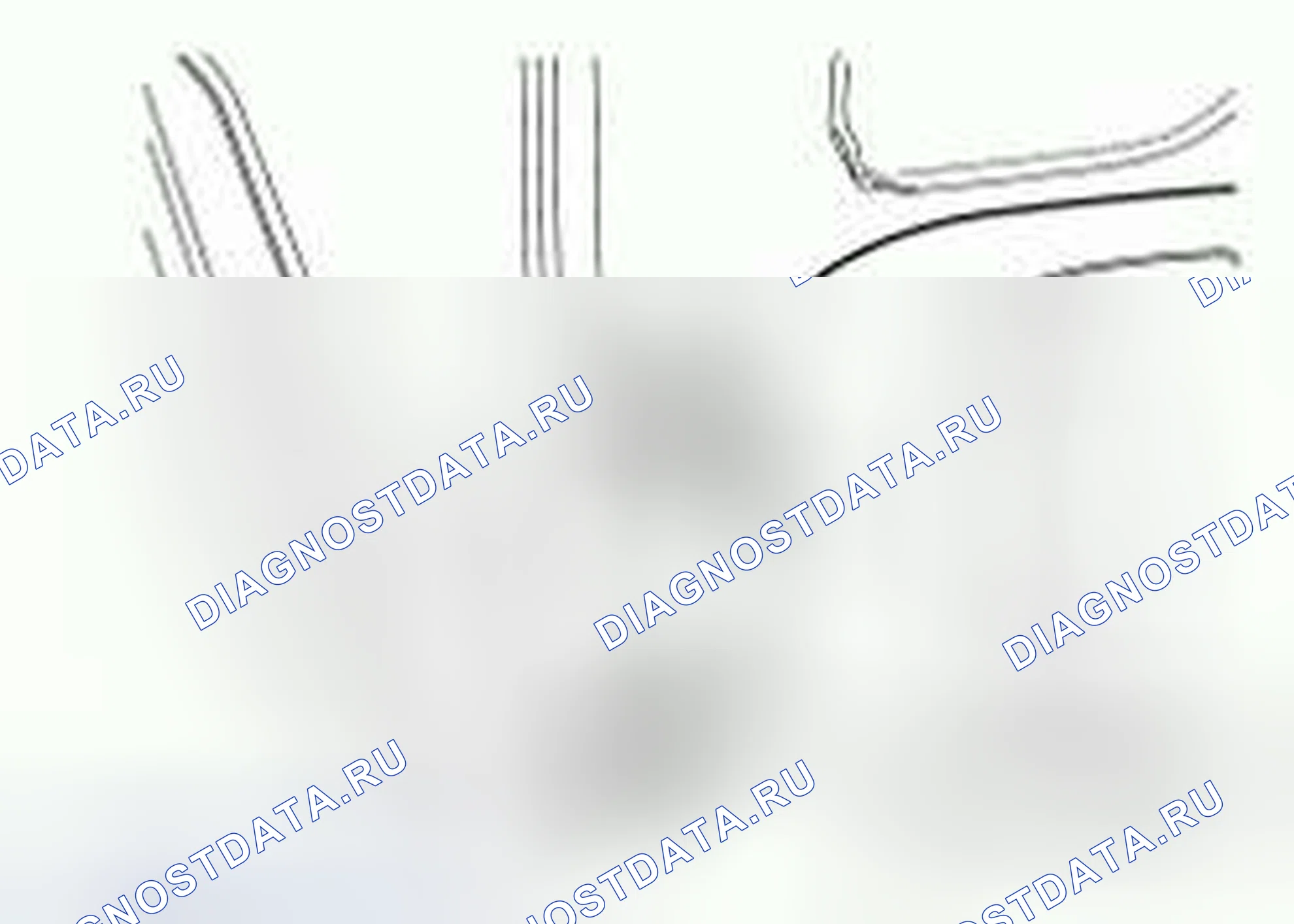 Рис. 54: Подшипник и ступица колеса - F450 и F550. Ford Pickup F250 Super Duty II