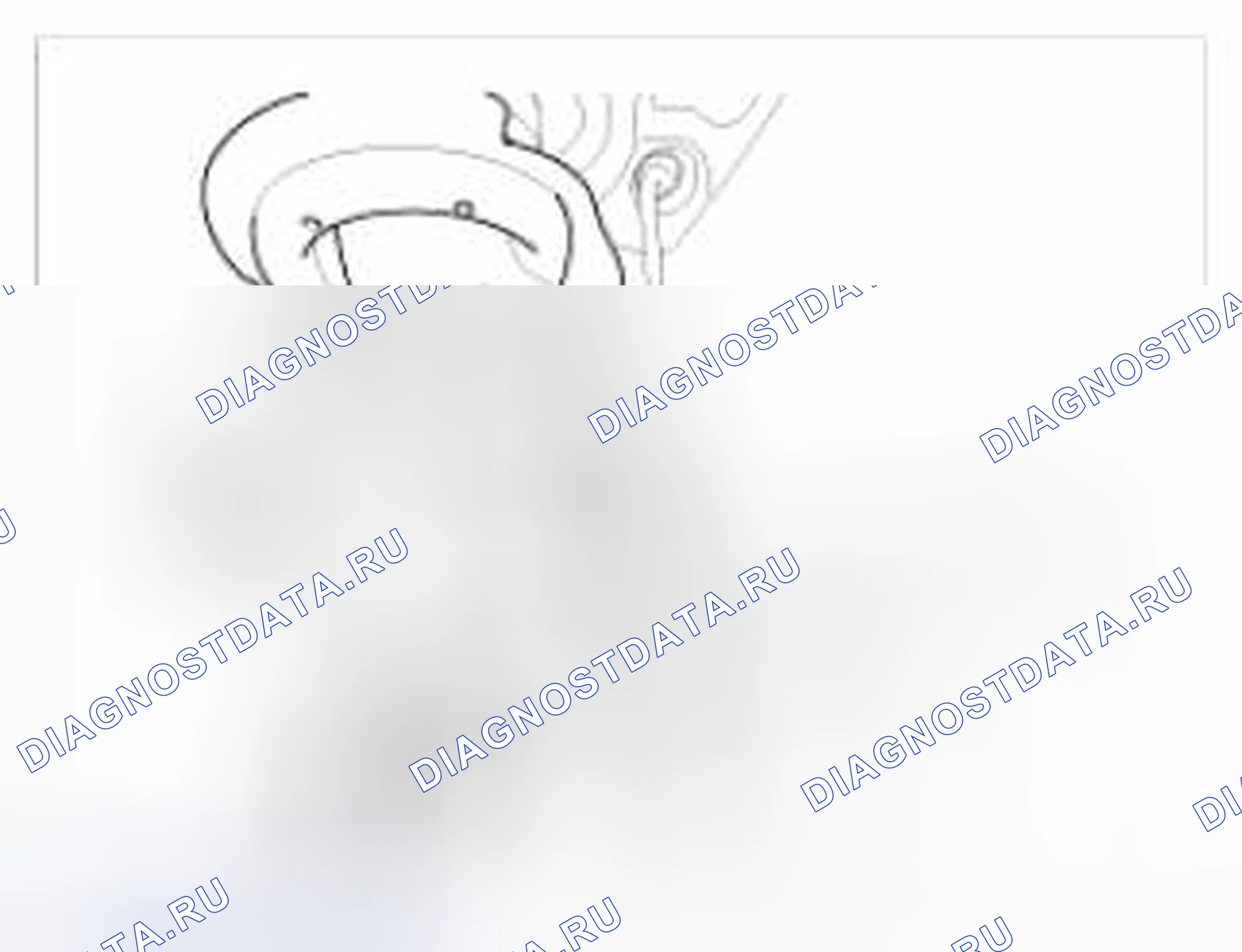 Рис. 9. BMW 6 серия F06/F13/F12