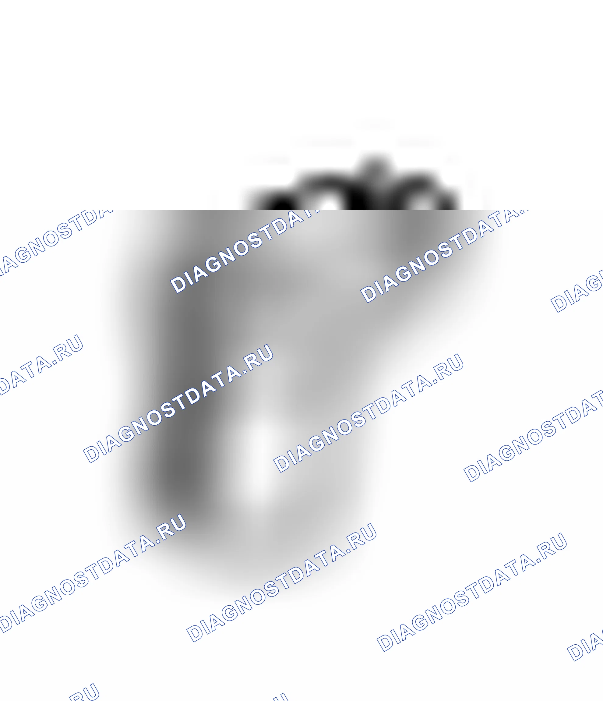 Рис. 21: SST. Kia Sorento I рестайлинг