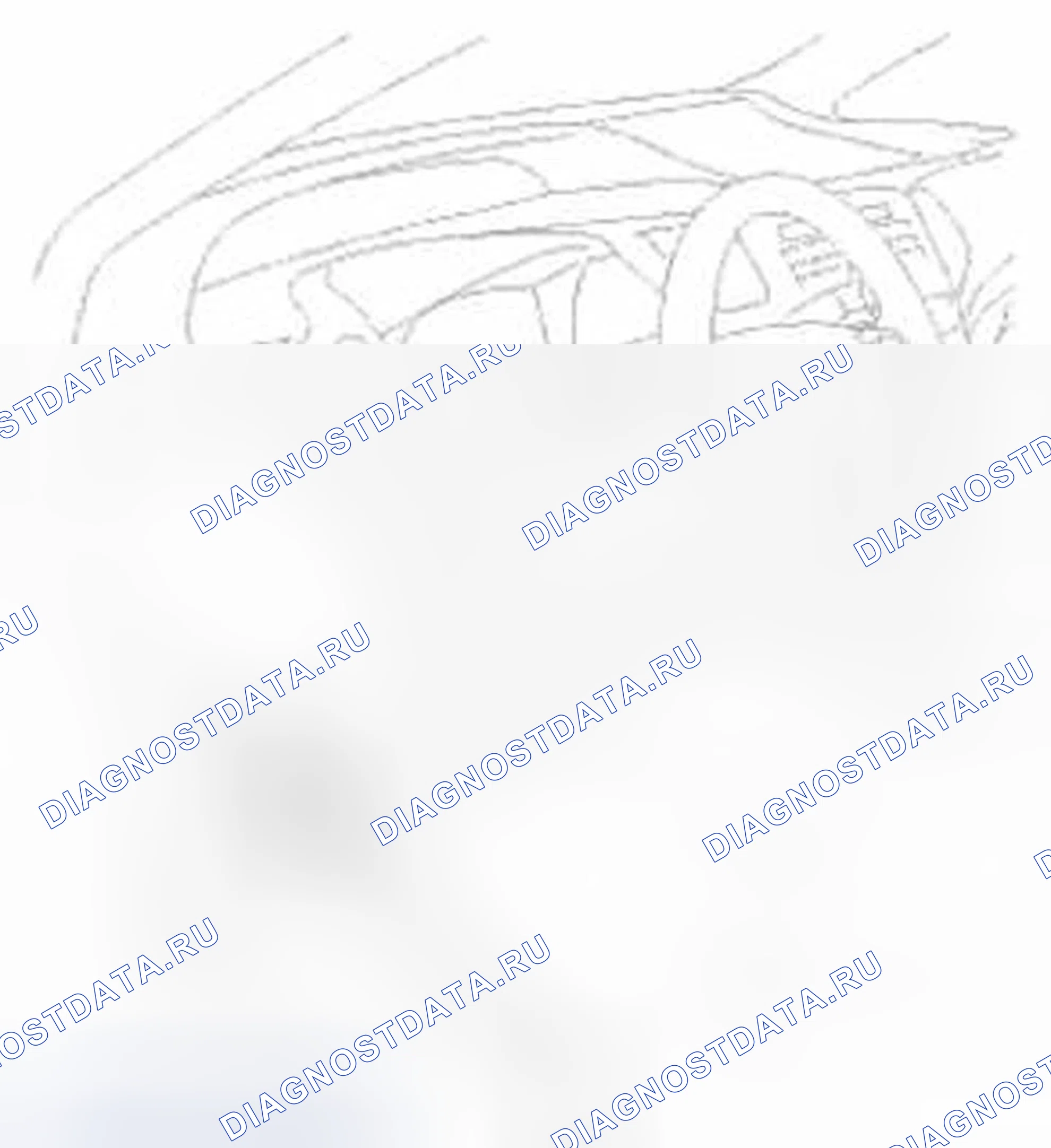 Рис. 655: Удаление. Honda Civic IX
