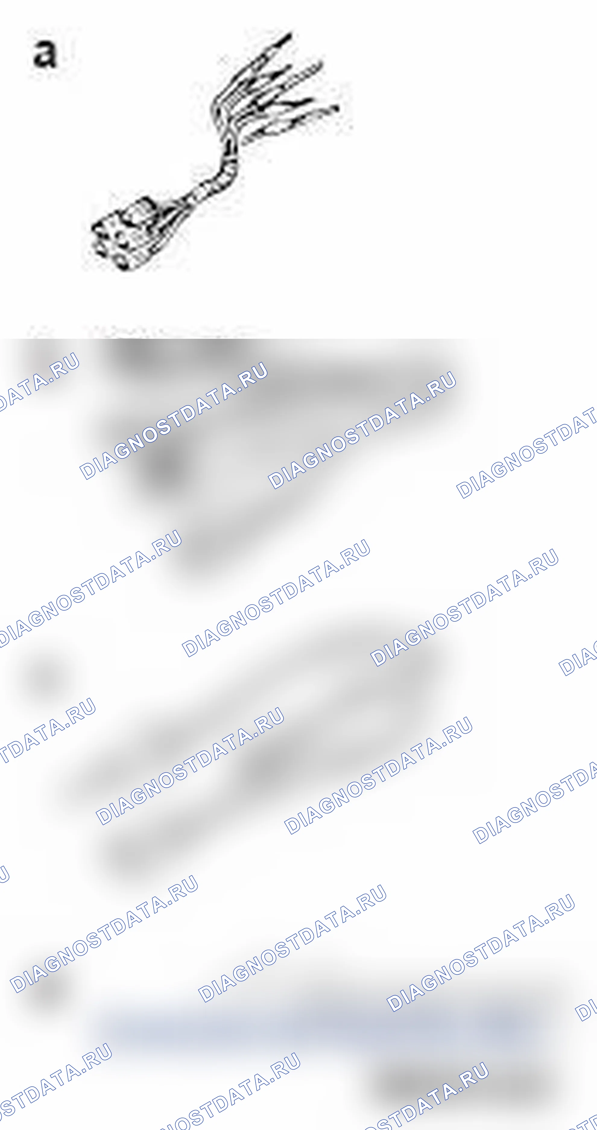 Рис. 6. Mitsubishi Lancer Ralliart X рестайлинг