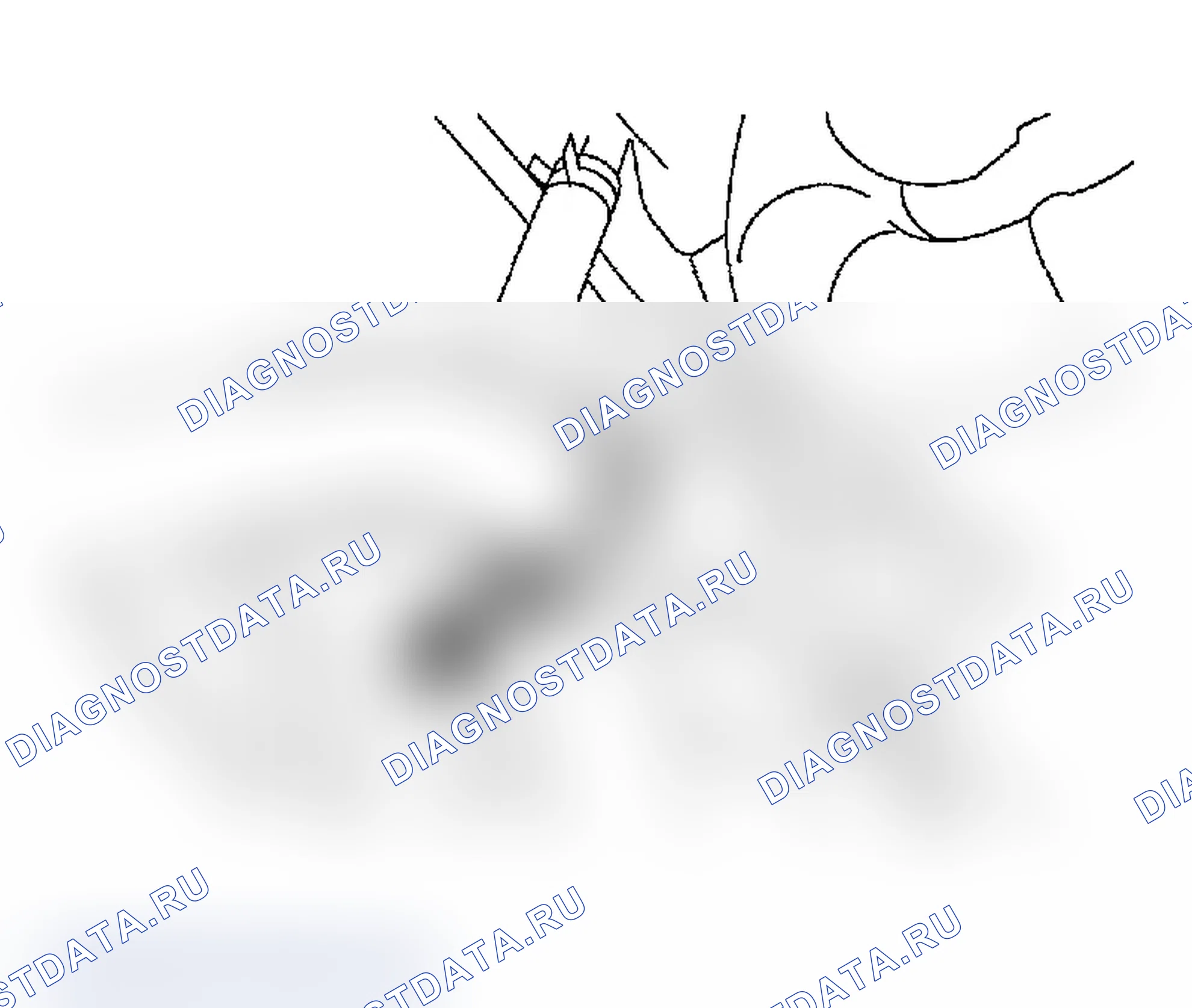 Рис. 60. Subaru Impreza WRX GD/GG рестайлинг
