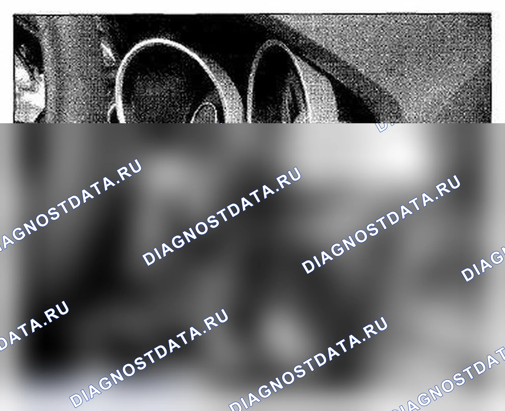 Рис. 1050: Расположение компонентов крышки рулевой колонки (фото 41). Acura TL IV