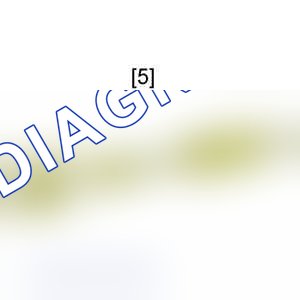 Разборка: коробка передач (типа ML5C) — e5ap2bbc. Citroen Jumpy I