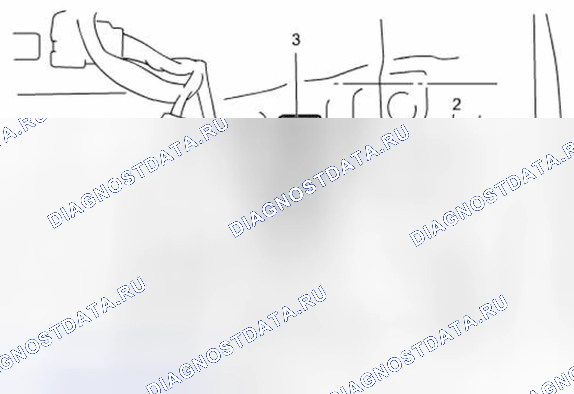 Рис. 187: Удаление. Suzuki Kizashi I