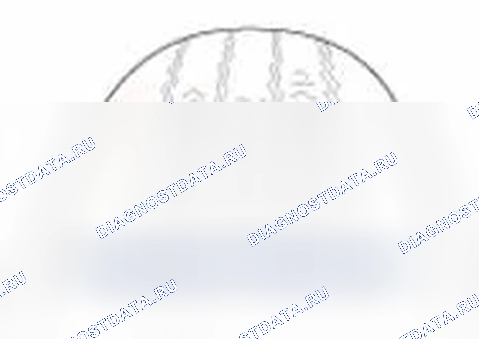 Рис. 45. Hyundai Elantra V