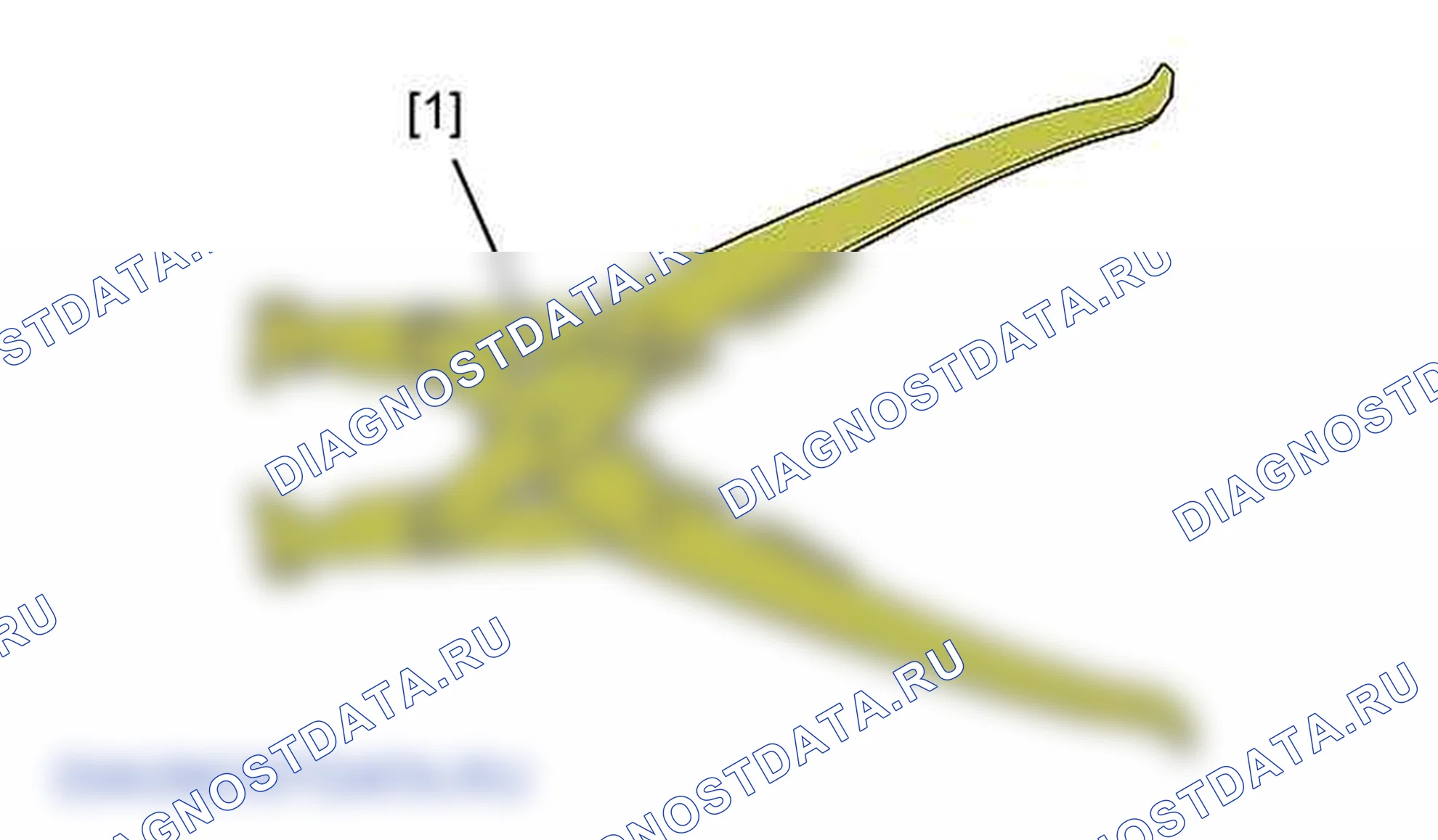 Снятие - Установка: турбокомпрессор — e5ap308d. Citroen C5 II