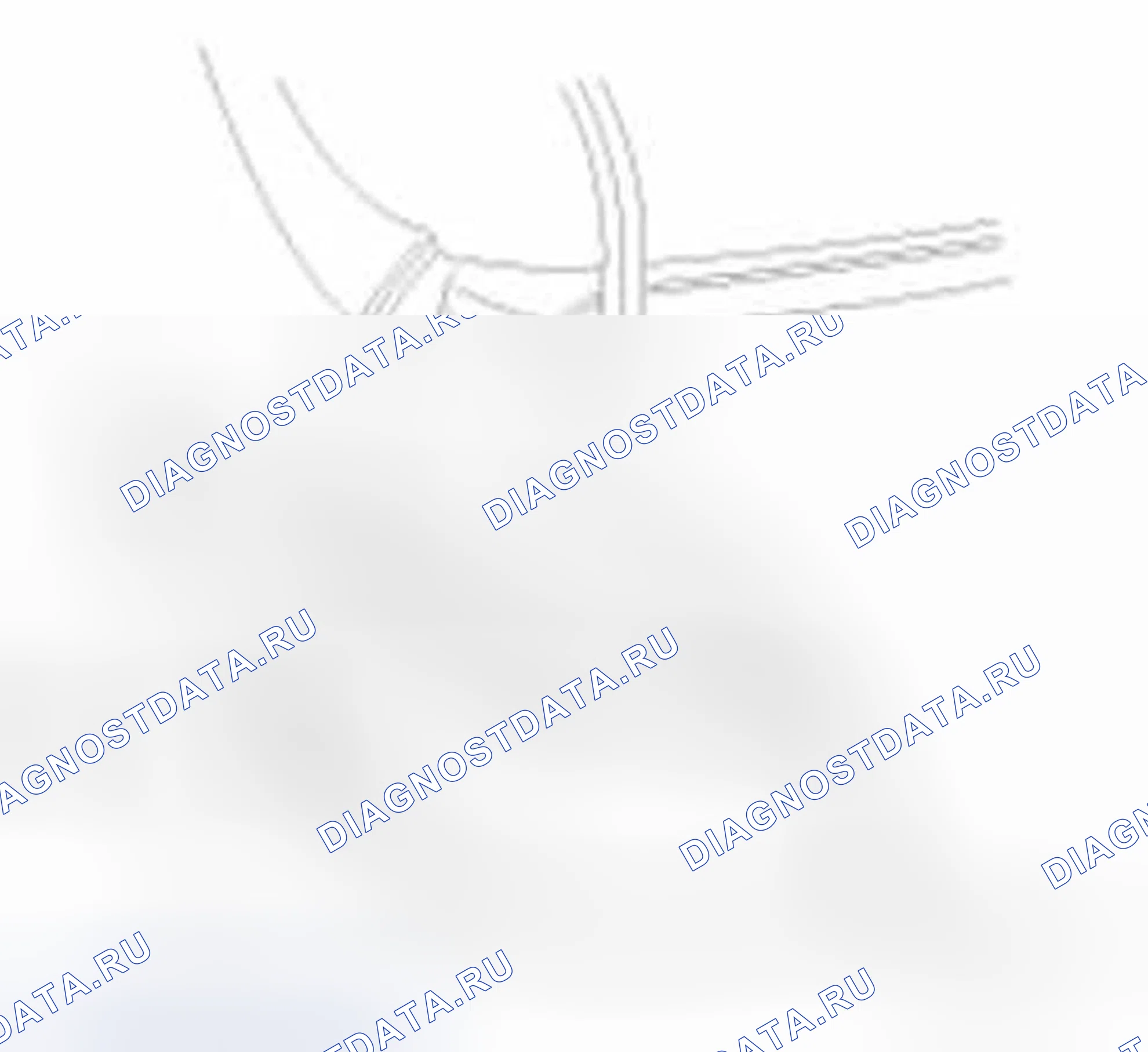 Рис. 26. Hyundai Elantra V